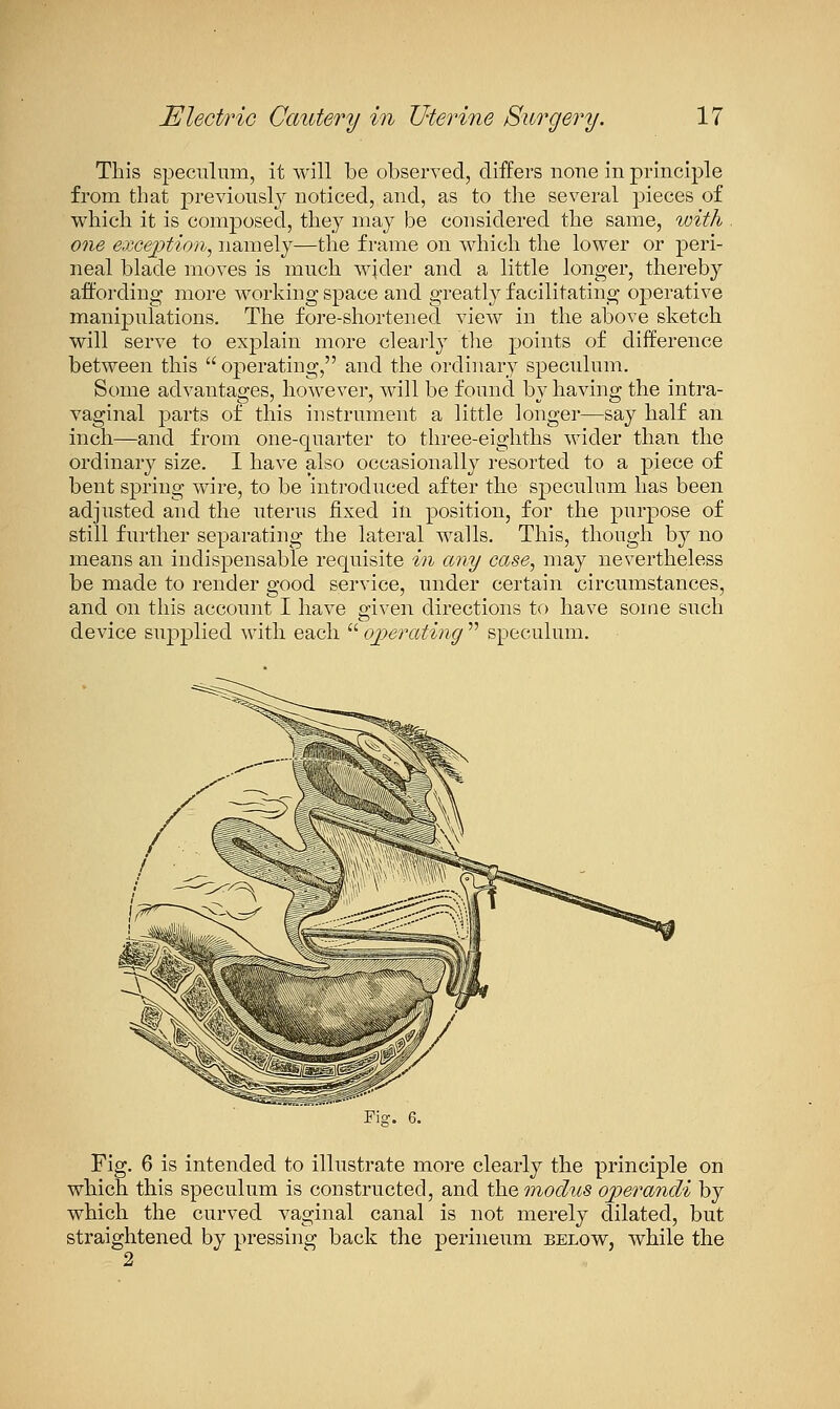 This speculum, it will be observed, differs none in principle from that previously noticed, and, as to tlie several pieces of which it is composed, they may be cousidered the same, with one excejption, namely—the frame on which the lower or peri- neal blade moves is much wjder and a little longer, thereby affording more working space and greatly facilitating operative manipulations. The fore-shortened view in the above sketch will serve to explain more clearly tlie points of difference between this  operating, and the ordinary speculum. Some advantages, however, will be found by having the intra- vaginal parts of this instrument a little longer—say half an inch—and from one-quarter to three-eighths wider than the ordinary size. I have also occasionally resorted to a piece of bent spring wire, to be introduced after the speculum has been adjusted and the uterus fixed in position, for the purpose of still further separatiug the lateral walls. This, though by no means an indispensable requisite in any case, may nevertheless be made to render good service, under certain circumstances, and on this account I have given directions to have some such device suj^plied with each  ojyerating  speculum. Fig. 6 is intended to illustrate more clearly the principle on which this speculum is constructed, and the modtis ojperandi by which the curved vaginal canal is not merely dilated, but straightened by pressing back the perineum below, while the 2