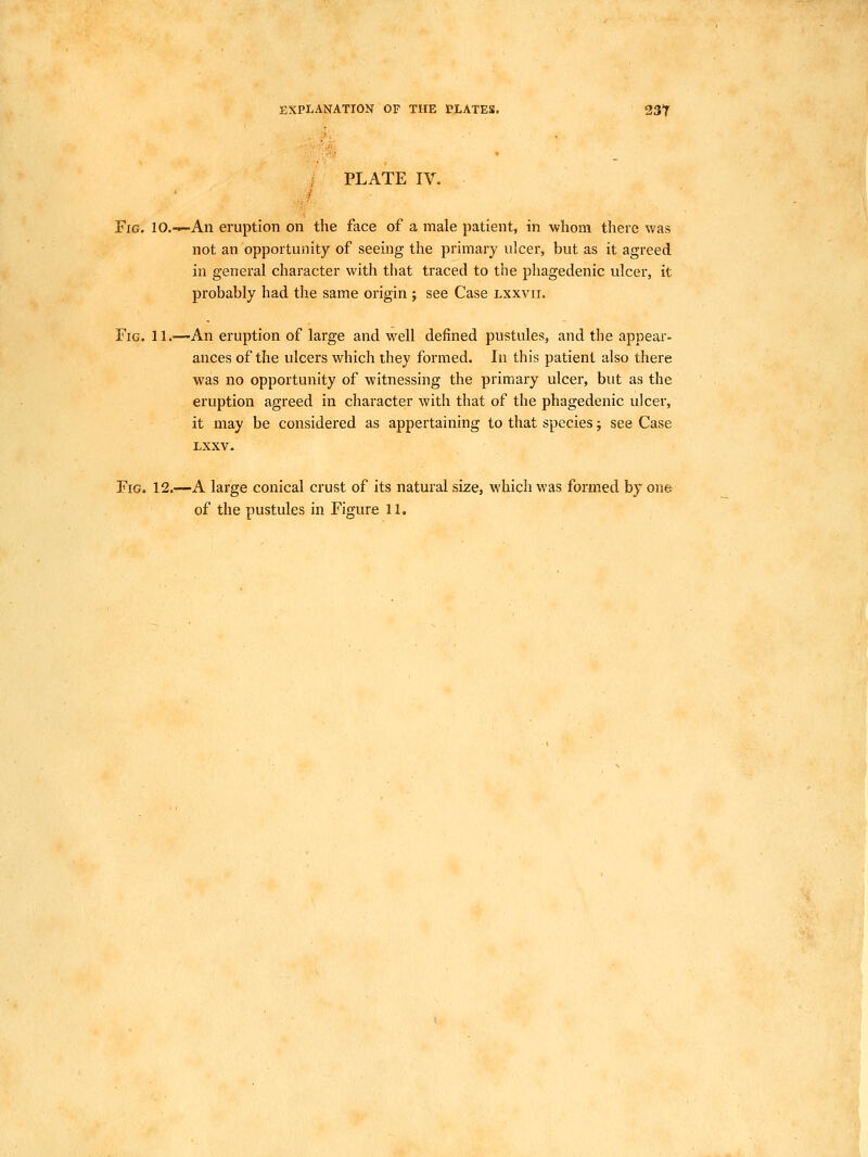 EXPLANATION OF THE PLATES. 23Y PLATE IV. Fig. lO.—An eruption on the face of a male patient, in whom there was not an opportunity of seeing the primary ulcer, but as it agreed in general character with that traced to the phagedenic ulcer, it probably had the same origin ; see Case lxxvii. Fig. 11.'—An eruption of large and well defined pustules, and the appear- ances of the ulcers which they formed. In this patient also there was no opportunity of witnessing the primary ulcer, but as the eruption agreed in character with that of the phagedenic ulcer, it may be considered as appertaining to that species; see Case LXXV. Fig. 12.—A large conical crust of its natural size, which was formed by one of the pustules in Figure 11.