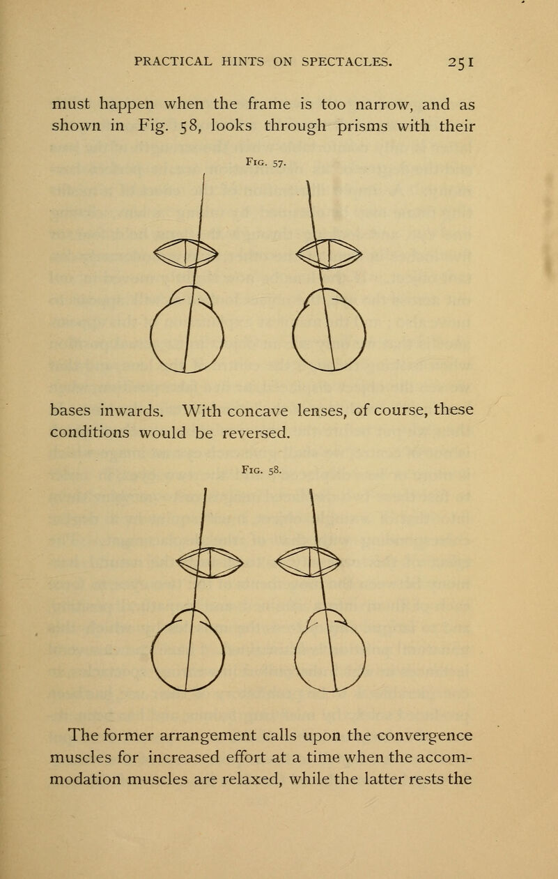 must happen when the frame is too narrow, and as shown in Fig. 58, looks through prisms with their Fig. 57. bases inwards. With concave lenses, of course, these conditions would be reversed. Fig. 58. The former arrangement calls upon the convergence muscles for increased effort at a time when the accom- modation muscles are relaxed, while the latter rests the