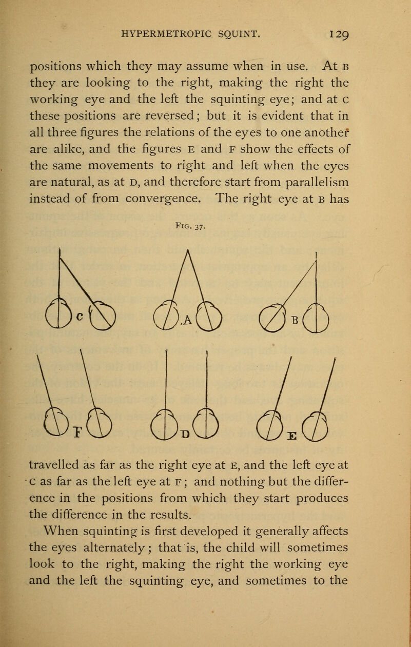 positions which they may assume when in use. At b they are looking to the right, making the right the working eye and the left the squinting eye; and at c these positions are reversed; but it is evident that in all three figures the relations of the eyes to one anothef are alike, and the figures e and f show the effects of the same movements to right and left when the eyes are natural, as at d, and therefore start from parallelism instead of from convergence. The right eye at b has Fig. 37. 6.6 travelled as far as the right eye at e, and the left eye at c as far as the left eye at f ; and nothing but the differ- ence in the positions from which they start produces the difference in the results. When squinting is first developed it generally affects the eyes alternately; that is, the child will sometimes look to the right, making the right the working eye and the left the squinting eye, and sometimes to the