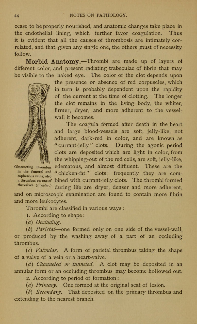 cease to be properly nourished, and anatomic changes take place in the endothelial lining, which further favor coagulation. Thus it is evident that all the causes of thrombosis are intimately cor- related, and that, given any single one, the others must of necessity follow. Morbid Anatomy.—Thrombi are made up of layers of different color, and present radiating trabeculae of fibrin that may be visible to the naked eye. The color of the clot depends upon the presence or absence of red corpuscles, which in turn is probably dependent upon the rapidity of the current at the time of clotting. The longer the clot remains in the living body, the whiter, firmer, dryer, and more adherent to the vessel- wall it becomes. The coagula formed after death in the heart and large blood-vessels are soft, jelly-like, not adherent, dark-red in color, and are known as *' currant-jelly  clots. During the agonic period clots are deposited which are light in color, from I the whipping-out of the red cells, are soft, jelly-Hke, Obstructing thrombus cdcmatous, and almost diffluent. These are the in the femoral and u chickcn-fat clots; frequently they are com- saphenous veins; also ^ j. • ^ a thrombus on one of bincd with currant-jelly clots. The thrombi formed tevaves. ( legier.) ^^^j-jj^g jjfg ^.VQ dryer, dcnser and more adherent, and on microscopic examination are found to contain more fibrin and more leukocytes. Thrombi are classified in various ways: 1. According to shape: {a) Occluding. (J?) Parietal—one formed only on one side of the vessel-wall, or produced by the washing away of a part of an occluding thrombus. (c) Valvular. A form of parietal thrombus taking the shape of a valve of a vein or a heart-valve. id) Channeled or tunneled. A clot may be deposited in an annular form or an occluding thrombus may become hollowed out. 2. According to period of formation : (a) Primary. One formed at the original seat of lesion. {8) Secondary. That deposited on the primary thrombus and extending to the nearest branch.