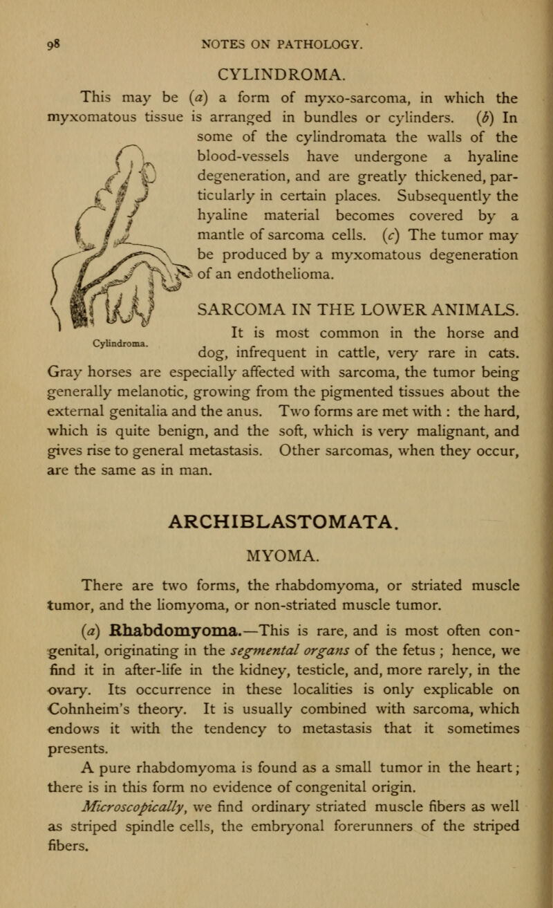^ This may be {a) a form of myxo-sarcoma, in which the myxomatous tissue is arranged in bundles or cylinders. {b) In blood-vessels have undergone a hyaline degeneration, and are greatly thickened, par- ticularly in certain places. Subsequently the hyaline material becomes covered by a mantle of sarcoma cells, {c) The tumor may be produced by a myxomatous degeneration \^ of an endothehoma. SARCOMA IN THE LOWER ANIMALS. It is most common in the horse and Cylindroma. . . -. . ^ dog, mfrequent m cattle, very rare m cats. Gray horses are especially affected with sarcoma, the tumor being generally melanotic, growing from the pigmented tissues about the external genitalia and the anus. Two forms are met with : the hard, which is quite benign, and the soft, which is very mahgnant, and gives rise to general metastasis. Other sarcomas, w^hen they occur, are the same as in man. ARCHIBLASTOMATA. MYOMA. There are two forms, the rhabdomyoma, or striated muscle tumor, and the liomyoma, or non-striated muscle tumor. {a) Rliabdomyonia.—This is rare, and is most often con- ■genital, originating in the segmental organs of the fetus ; hence, we find it in after-life in the kidney, testicle, and, more rarely, in the ovary. Its occurrence in these localities is only explicable on Cohnheim's theory. It is usually combined with sarcoma, which endows it with the tendency to metastasis that it sometimes presents. A pure rhabdomyoma is found as a small tumor in the heart; there is in this form no evidence of congenital origin. Microscopically, we find ordinary striated muscle fibers as well as striped spindle cells, the embryonal forerunners of the striped fibers.