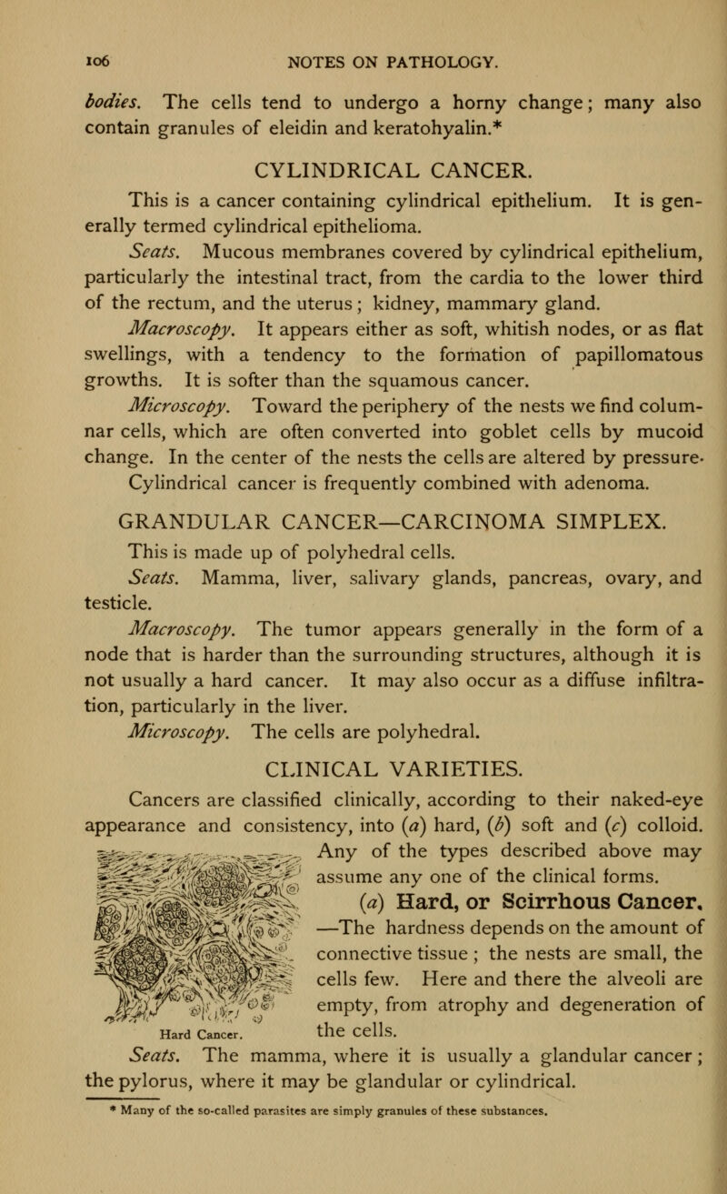 bodies. The cells tend to undergo a horny change; many also contain granules of eleidin and keratohyalin.* CYLINDRICAL CANCER. This is a cancer containing cylindrical epithelium. It is gen- erally termed cylindrical epithelioma. Seats. Mucous membranes covered by cylindrical epithelium, particularly the intestinal tract, from the cardia to the lower third of the rectum, and the uterus; kidney, mammary gland. Macroscopy. It appears either as soft, whitish nodes, or as flat swellings, with a tendency to the formation of papillomatous growths. It is softer than the squamous cancer. Microscopy. Toward the periphery of the nests we find colum- nar cells, which are often converted into goblet cells by mucoid change. In the center of the nests the cells are altered by pressure- Cylindrical cancer is frequently combined with adenoma. GRANDULAR CANCER—CARCINOMA SIMPLEX. This is made up of polyhedral cells. Seats. Mamma, liver, salivary glands, pancreas, ovary, and testicle. Macroscopy. The tumor appears generally in the form of a node that is harder than the surrounding structures, although it is not usually a hard cancer. It may also occur as a diffuse infiltra- tion, particularly in the liver. Microscopy. The cells are polyhedral. CLINICAL VARIETIES. Cancers are classified clinically, according to their naked-eye appearance and consistency, into [a) hard, (^) soft and {c) colloid. Any of the types described above may assume any one of the clinical forms. {a) Hard, or Scirrhous Cancer, —The hardness depends on the amount of connective tissue ; the nests are small, the cells few. Here and there the alveoli are ^>i'Si^>; *^^ empty, from atrophy and degeneration of Hard Cancer. the CClls. Seats. The mamma, where it is usually a glandular cancer; the pylorus, where it may be glandular or cylindrical. * Many of the so-called parasites are simply granules of these substances.