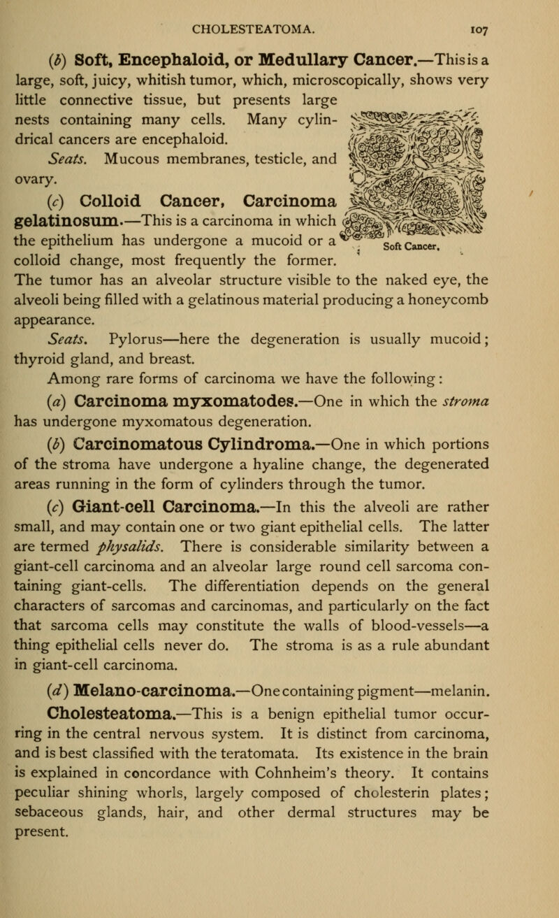 Soft Cancer. {b) Soft, Encephaloid, or Medullary Cancer.—This is a large, soft, juicy, whitish tumor, which, microscopically, shows very little connective tissue, but presents large nests containing many cells. Many cylin- drical cancers are encephaloid. Seats, Mucous membranes, testicle, and ovary. {c) Colloid Cancer, Carcinoma gelatinosuni>—This is a carcinoma in which the epithelium has undergone a mucoid or a colloid change, most frequently the former. The tumor has an alveolar structure visible to the naked eye, the alveoli being filled with a gelatinous material producing a honeycomb appearance. Seats, Pylorus—here the degeneration is usually mucoid; thyroid gland, and breast. Among rare forms of carcinoma we have the following: {a) Carcinoma myxomatodes.—One in which the stroma has undergone myxomatous degeneration. {b) Carcinomatous Cylindroma.—One in which portions of the stroma have undergone a hyaline change, the degenerated areas running in the form of cylinders through the tumor. {c) Giant-cell Carcinoma.—In this the alveoli are rather small, and may contain one or two giant epithelial cells. The latter are termed physalids. There is considerable similarity between a giant-cell carcinoma and an alveolar large round cell sarcoma con- taining giant-cells. The differentiation depends on the general characters of sarcomas and carcinomas, and particularly on the fact that sarcoma cells may constitute the walls of blood-vessels—a thing epithelial cells never do. The stroma is as a rule abundant in giant-cell carcinoma. (^) Melano-carcinoma.—One containing pigment—melanin. Cholesteatoma.—This is a benign epithelial tumor occur- ring in the central nervous system. It is distinct from carcinoma, and is best classified with the teratomata. Its existence in the brain is explained in concordance with Cohnheim's theory. It contains peculiar shining whorls, largely composed of cholesterin plates; sebaceous glands, hair, and other dermal structures may be present.