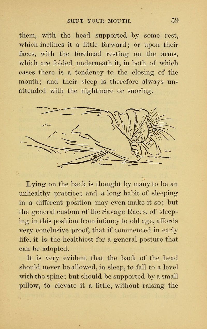 them, with the head supported by some rest, which inchnes it a Httle forward; or upon their faces, with the forehead resting on the arms, which are folded underneath it, in both of which cases there is a tendency to the closing of the mouth; and their sleep is therefore always un- attended with the nightmare or snoring. Lying on the back is thought by many to be an unhealthy practice; and a long habit of sleeping in a different position may even make it so; but the general custom of the Savage Races, of sleep- ing in this position from infancy to old age, affords very conclusive proof, that if commenced in early life, it is the healthiest for a general posture that can be adopted. It is very evident that the back of the head should never be allowed, in sleep, to fall to a level with the spine; but should be supported by a small pillow, to elevate it a little, without raising the