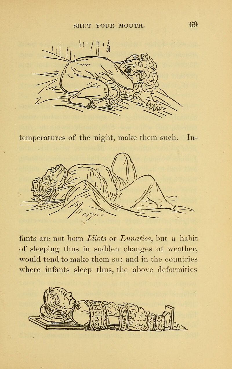 • / I! ! i ' II 3 temperatures of the night, make them such. In- fants are not born Idiots or Lunatics, but a habit of sleeping thus in sudden changes of weather, would tend to make them so; and in the counti'ies where infants sleep thus, the above deformities