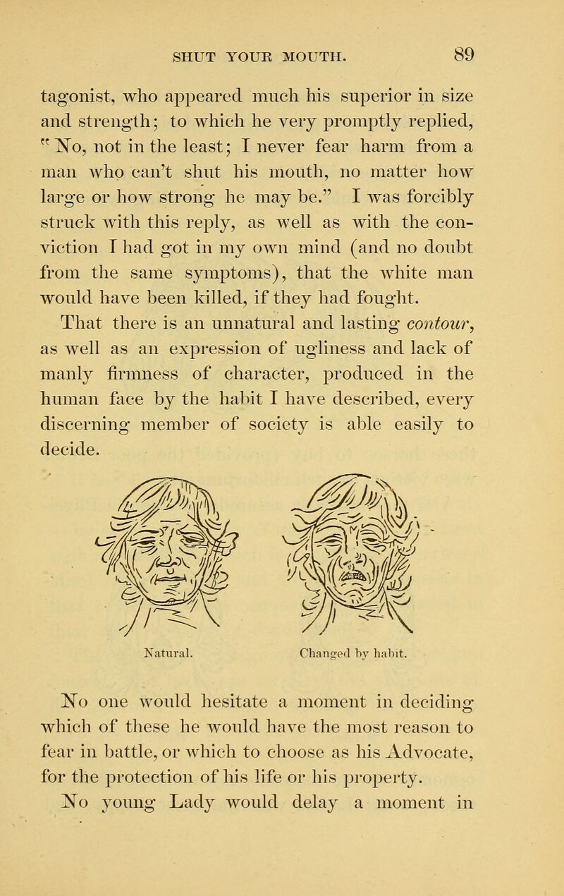 tagonist, who aj^pearecl much his superior in size and strength; to whicli he very promptly repHed,  'No, not in the least; I never fear harm from a man who can't shut his mouth, no matter how large or how strong he may be. I was forcibly struck with this reply, as well as with the con- viction I had got in my own mind (and no doubt from the same symptoms), that the white man would have been killed, if they had fought. That there is an unnatural and lasting contour, as well as an expression of ugliness and lack of manly firmness of character, j^i'oduced in the human face by the habit I have described, every discerning member of society is able easily to decide. Natural. Changed by habit. No one would hesitate a moment in decidinof which of these he would have the most reason to fear in battle, or which to choose as his Advocate, for the protection of his life or his property. ^o young Lady would delay a moment in