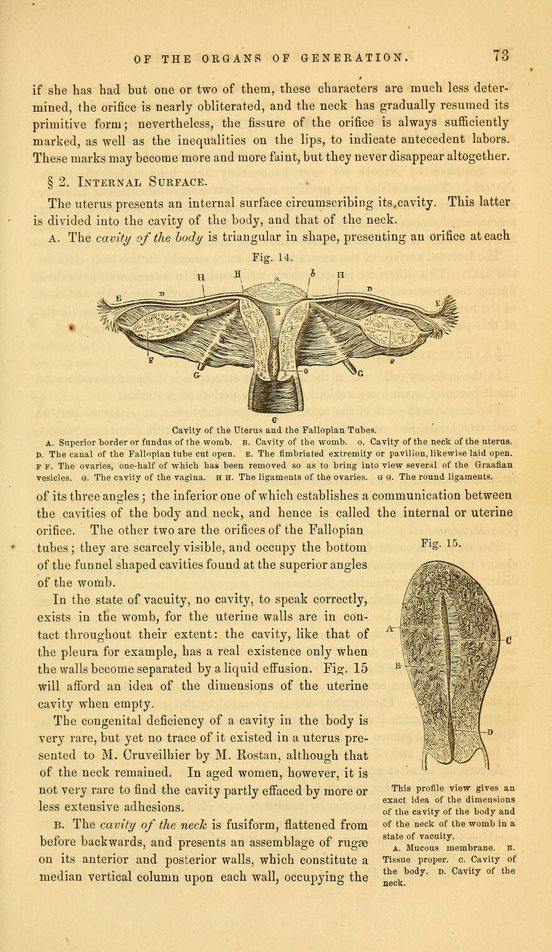 if she has had but one or two of them, these characters are much less deter- mined, the orifice is nearly obliterated, and the neck has gradually resumed its primitive form; nevertheless, the fissure of the orifice is always sufficiently marked, as well as the inequalities on the lips, to indicate antecedent labors. These marks may become more and more faint, but they never disappear altogether. § 2. Internal Surface. The uterus presents an internal surface circumscribing its.cavity. This latter is divided into the cavity of the body, and that of the neck. A. The cavity of the body is triangular in shape, presenting an orifice at each Fig. 14. Fig. 15. Cavity of the Uterus and the Fallopian Tubes. A. Superior border or fundus of the womb. b. Cavity of the womb. o. Cavity of the neck of the uterus. D. The canal of the Fallopian tube cut open. e. The fimbriated extremity or pavilion, likewise laid open. F f. The ovaries, one-half of which has been removed so as to bring into view several of the Graafian vesicles. G. The cavity of the vagina, h h. The ligaments of the ovaries. e a. The round ligaments. of its three angles; the inferior one of which establishes a communication between the cavities of the body and neck, and hence is called the internal or uterine orifice. The other two are the orifices of the Fallopian tubes; they are scarcely visible, and occupy the bottom of the funnel shaped cavities found at the superior angles of the womb. In the state of vacuity, no cavity, to speak correctly, exists in the womb, for the uterine walls are in con- tact throughout their extent: the cavity, like that of the pleura for example, has a real existence only when the walls become separated by a liquid effusion. Fi°;. 15 will afford an idea of the dimensions of the uterine cavity when empty. The congenital deficiency of a cavity in the body is very rare, but yet no trace of it existed in a uterus pre- sented to M. Cruveilhier by M. Rostan, although that of the neck remained. In aged women, however, it is not very rare to find the cavity partly effaced by more or less extensive adhesions. B. The cavity of the neck is fusiform, flattened from before backwards, and presents an assemblage of rugae on its anterior and posterior walls, which constitute a median vertical column upon each wall, occupying the This profile view gives an exact idea of the dimensions of the cavity of the body and of the neck of the womb in a state of vacuity. A. Mucous membrane, b. Tissue proper, c. Cavity of the body. d. Cavity of the neck.