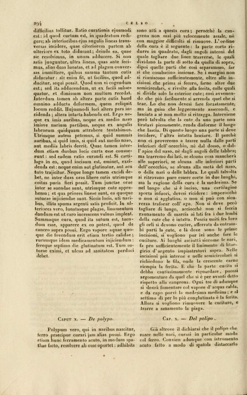 2o/| CELSO diffìcilius tollitur. Ratio curationis ejusmodi est : i<l quod curtum est, in quadratimi redi- gere; ab interioribus ejus angulis lineas trans- versas incidere, quae citerioreni pattern ab ulteriore ex toto didueant; deinde ea, quae sic resolvimus, in unum adducere. Si non satis junguntur, ultra lineas, quas ante feci- mus, alias duas lunatas, et a<l piagano conver- sas irnmittere, quibus su ni ma tantum cutis diducatur : sic enim fit, ut facilius, quod ad- ducitur, sequi possit. Quod non vi cogenduni est; sed ita adducendum, ut ex facili subse- quatur, et dimissum non multano recedat. Interdum tamen ab altera parte cutis haud omnino adducta deformem, quem reliquit locum reddit. Hujusmodi loci altera pars io* cidenda ; altera intarla habenda est. Lrgo ne- que ex. imis auribus, ncque ex medio naso imisve narium partibus, ncque ex angulis labrorum quidquam atlrahere ienlabimus. Utrimque autem petemus, si quid summis auribus, si quid imis, si quid aut medio naso, aut mediis labris deerit. Quae tamen inter- dum etiam duobus locis curia esse consue- runt : sed eadem ratio curandi est. Si carti- lago in eo, quod incisimi est. eminet, exci- denda est : ncque enim aut glutinatur, aut «cu tuto Irajicitur. Neque longe tamen excidi de- l>et, ne inter duas oras libere cutis utrimque coitus puris fieri possit. Tu ni junctae orae inler se suendae sunt, utrimque cute appre- hensa ; et qua priores lineae sunt, ea qaoqae suturai- injiciendae sunt. Siccis locis. uti nari- bus, illita spuma argenti satis proficit. In ul- teriores vero, lunatasquc plajjas, linamentum dandum est ut caro increscens vulnus impleat. Summaque cura, quod ila sulum est, tuen- dam esse, apparere ex co potesl, quod de cancro lopra posui. Ergo rapore oqoae quo- que die fovendnra erit etiam tertio ealidae ; rursusque idem roedicaraentum injiciendara : fereque scptiiuo die platinatura est. 'I un» SU* lurae eximi, et ulcus ad sanitalem perduci debet. Caput \. — Ih poìypo. sono alti a questa cura ; perocché la can- crena non mai più velocemente assale, uè con maggior difficoltà si rimuove. L* online della cura è il seguente : la parte corta ri- durre io quadrato, dagli angoli interni del quale tagliare due linee trasverse, le quali dividano la parte di solto da quella di sopra, dipoi quelle parti che così separammo, far sì che combacino insieme. Se i margini non si riuniscono sufficientemente, oltre alle in- cisioni che prima si fecero, farne altre due semicircolari, e rivolte alla ferita, colle quali si divide solo la eslerior cute; così avvenen- do che più facilmente si arrenda quel che si trae. Lo che non devesi fare forzatamente* ma in guisa che leggermente assecondi, e lasciata a sé non molto si ritragga. Interviene però talvolta che la cute da una parte non tiratavi pienamente, renda disforme il luogo che lascia. Di questo luogo una parte si deve incidere, V altra inlalla lasciare. Il pecche non ci proveremo a trarre nulla dalle parti inferiori dell1 orecchio, né dal dosso, o dal- l'apice del naso, né dagli angoli delle labbra; ma trarremo dai lati, se alcuna cosa mancherà alle superiori, se alcuna alle inferiori parli dell1 orecchio, se alcuna alla metà del naso, o delle nari o delle labbra. Le quali talvolta si ritrovano pure essere corle in due luoghi, ma la ragione della cura è la medesima. Se nel luogo che si è inciso, una cartilagine sporta infuori, devesi ricidere : imperocché o non si agglutina, o non si può con sicu- rezza trafurar coli1 ago. Non si deve però tagliare di lunge, acciocché non si faccia raunamenlo di marcia ai lati fra i due lembi della cute che è intatta. Poscia uniti fra loro gli orli si devono cucire, afferrata da entram- bi parti la cute, e là dove sono le prime incisioni, si vogliono pur ivi anche foce le cuciture. Ai luoghi asciutti siccome le nari, fa prò sufficientemente il linimento di lilar- gicio dvargento impiastratovi sopra. Nelle incisioni più interne e nelle semicircolari SI richiedono le fila, onde U crescente carne riempia la ferita. E che la parte em ili si debba cani issimamente riguardare, pUOSM argomentare dà quel che si «'• per nvinti detto cispelto alla caofcena. Ogni Ire di adunque si dovrà fomentare Col vapore d'acqua calda, e da capo porvi l.i medesimi» medicina ; e al settimo di per lo più cODglutinaU è la lenta. Allora si vogliono rimuovere le cuciture, e trarre a sanamento la piaga. Cai-. \. — Del polipo . Polypum vero, qui in Bacioni nascitura terrò pr.ici ipur- curari jam alias posili. l'.rgo r liana bum ferramento acuta, in modom ipe> tliuc fido, rcsolverc ab osscoportet : udlnbila Gii altrove il dichiarai «he il polipo die nasce nel!.- dui. cacasi in partieolac modo col ferro. Convien adunque COO istromento ..culo latto | mudo di spatola distaccarlo