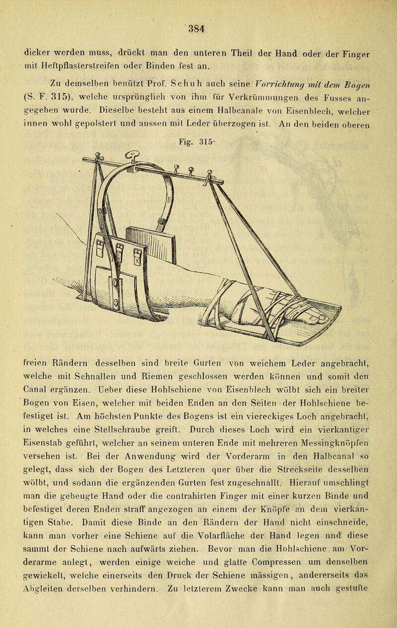 dicker werden muss, drückt man den unteren Theil der Hand oder der Finger mit Heftpflaslerstreifen oder Binden fest an. Zu demselben benutzt Prof. Schuh auch seine Vorrichtung mit dem Bogen (S. F. 315), welche ursprünglich von ihm für Verkrümmungen des Fusses an- gegeben wurde. Dieselbe besteht aus einem Halbcanale von Eisenblech, welcher innen wohl gepolstert und aussen mit Leder überzogen ist. An den beiden oberen freien Rändern desselben sind breite Gurten von weichem Leder angebracht, welche mit Schnallen und Riemen geschlossen werden können und somit den Canal ergänzen. Ueber diese Hohlschiene von Eisenblech wülbt sich ein breiter Bogen von Eisen, welcher mit beiden Enden an den Seiten der Hohlschiene be- festiget ist. Am höchsten Punkte des Bogens ist ein viereckiges Loch angebracht, in welches eine Stellschraube greift. Durch dieses Loch wird ein vierkantiger Eisenstab geführt, welcher an seinem unteren Ende mit mehreren Messingknöpfen versehen ist. Bei der Anwendung wird der Vorderarm in den Halbcanal so gelegt, dass sich der Bogen des Letzteren quer über die Streckseite desselben wölbt, und sodann die ergänzenden Gurten fest zugeschnallt. Hierauf umschlingt man die gebeugte Hand oder die contrahirten Finger mit einer kurzen Binde und befestiget deren Enden straff angezogen an einem der Knöpfe an dein vierkan- tigen Stabe. Damit diese Binde an den Rändern der Hand nicht einschneide, kann man vorher eine Schiene auf die Volarfläche der Hand legen nnd diese sammt der Schiene nach aufwärts ziehen. Bevor man die Hohlschiene am Vor- derarme anlegt, werden einige weiche und glatte Compressen um denselben gewickelt, welche einerseits den Druck der Schiene massigen, andererseits das Abgleiten derselben verhindern. Zu letzlerem Zwecke kann man auch gestufte