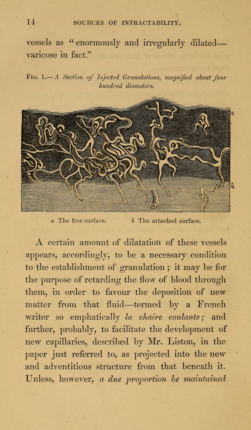 vessels as enormously and irregularly dilated- varicose in fact. Fig. 1.—A Section of Injected Granulations, magnified about four hundred diameters. a The free surface. h The attached surface. A certain amount of dilatation of these vessels appears, accordingly, to be a necessary condition to the establishment of granulation ; it may be for the purpose of retarding the flow of blood through them, in order to favour the deposition of new matter from that fluid—termed by a French writer so emphatically la cliaire coulante; and further, probably, to facilitate the development of new capillaries, described by Mr. Liston, in the paper just referred to, as projected into the new and adventitious structure from that beneath it. Unless, however, a due proportion he maintained