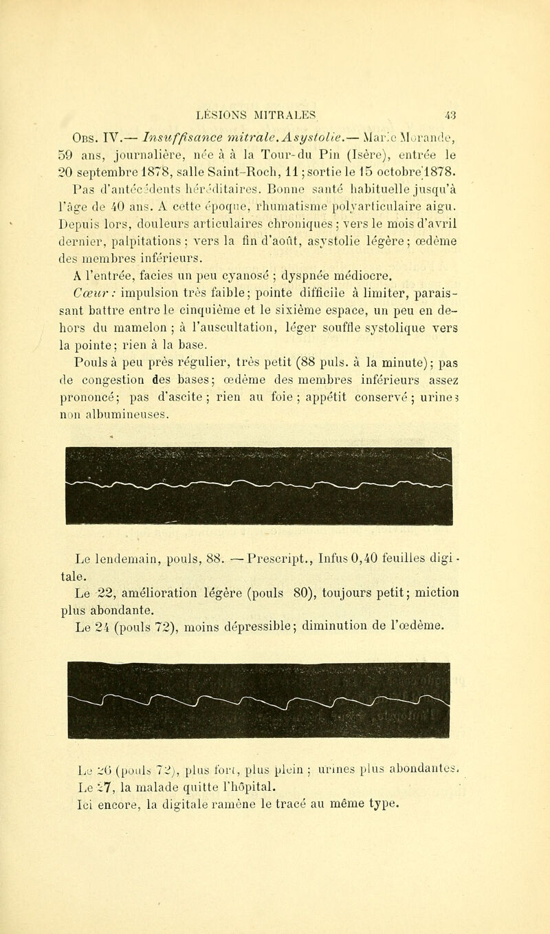 Obs. IV.— Insuffisance mitrale. Asystolle.— Marie Morancle, 59 ans, journalière, née à à la Tour-du Pin (Isère), entrée le 20 septembre 1878, salle Saint-Roch, il ; sortie le 15 octobre'1878. Pas d'antéc:îdents héréditaires. Bonne santé habituelle jusqu'à l'âge de 40 ans. A cette époque, rhumatisme polvarliculaire aigu. Depuis lors, douleurs articulaires chroniques ; vers le mois d'avril dernier, palpitations; vers la fin d'août, asystolie légère; œdème des membres inférieurs. A l'entrée, faciès un peu cyanose ; dyspnée médiocre. Cœur : impulsion très faible; pointe difficile à limiter, parais- sant battre entre le cinquième et le sixième espace, un peu en de- hors du mamelon ; à l'auscultation, léger souffle systolique vers la pointe; rien à la base. Pouls à peu près régulier, très petit (88 puis, à la minute) ; pas de congestion des bases; œdème des membres inférieurs assez prononcé; pas d'ascite ; rien au foie; appétit conservé; urine? non albumineuses. Le lendemain, pouls, 88. —Prescript., Infus0,40 feuilles digi- tale. Le 22, amélioration légère (pouls 80), toujours petit; miction plus abondante. Le 24 (pouls 72), moins dépressible ; diminution de l'œdème. Le -^iS (pouls 72), plus fort, plus plein ; urines plus abondantes, Le 27, la malade quitte l'hôpital. Ici encore, la digitale ramène le tracé au même type.