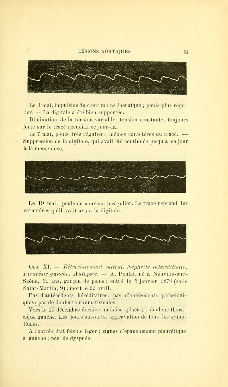 Le 3 mai, impulsion du cœur moins énergique ; pouls plus régu- lier. — La digitale a été bien supportée. Diminution de la tension variable; tension constante, toujours forte sur le tracé recueilli ce jour-là. Le 7 mai, pouls très régulier; mêmes caractères du tracé. — Suppression de la digitale, qui avait été continuée jusqu'à ce jour à la même dose. Le 19 mai, pouls de nouveau irrégulier. Le tracé reprend les caractères qu'il avait avant la digitale. Obs. XI. — Rétrécissement mitral. Néph^-ite interstitielle. Pleurésie gauche. Autopsie. — A. Poulat, né à Neuville-sur- Saône, 51 ans, garçon de peine ; entré le 5 janvier 1879 (salle Saint-Martin, 9) ; mort le 22 avril. Pas d'antécédents héréditaires; pas d'antécédents pathologi- ques; pas de douleurs rhumatismales. Vers le 15 décembre dernier, malaise général ; douleur thora - cique gauche. Les jours suivants, aggravation de tous les symp- tômes. A l'entrée, état fébrile léger ; signes d'épanchement pleurétique à gauche ; peu de dyspnée.