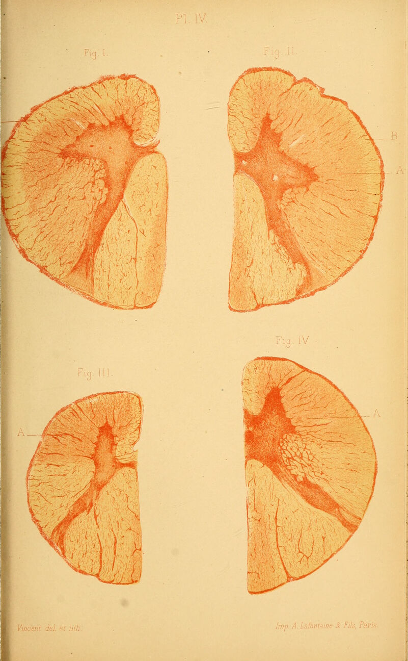 .4' / --^-•-1' -, ..■A.:^iMâ Vinceii r'\Q. IV