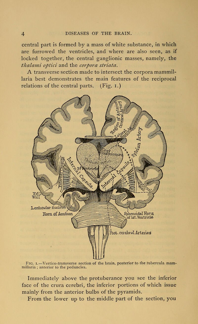 central part is formed by a mass of white substance, in which are furrowed the ventricles, and where are also seen, as if locked together, the central ganglionic masses, namely, the thalaini optici and the corpora striata. A transverse section made to intersect the corpora mammil- laria best demonstrates the main features of the reciprocal relations of the central parts. (Fig. i.) Txt' Wal' Lenticular Horn of Amilaon Sphenoidal Horn oflat.Venlricle Post, cerebral Arteries Fig. I.—Vertico-transverse section of the brain, posterior to the tubercula mam- millaria ; anterior to the peduncles. Immediately above the protuberance you see the inferior face of the crura cerebri, the inferior portions of which issue mainly from the anterior bulbs of the pyramids. From the lower up to the middle part of the section, you