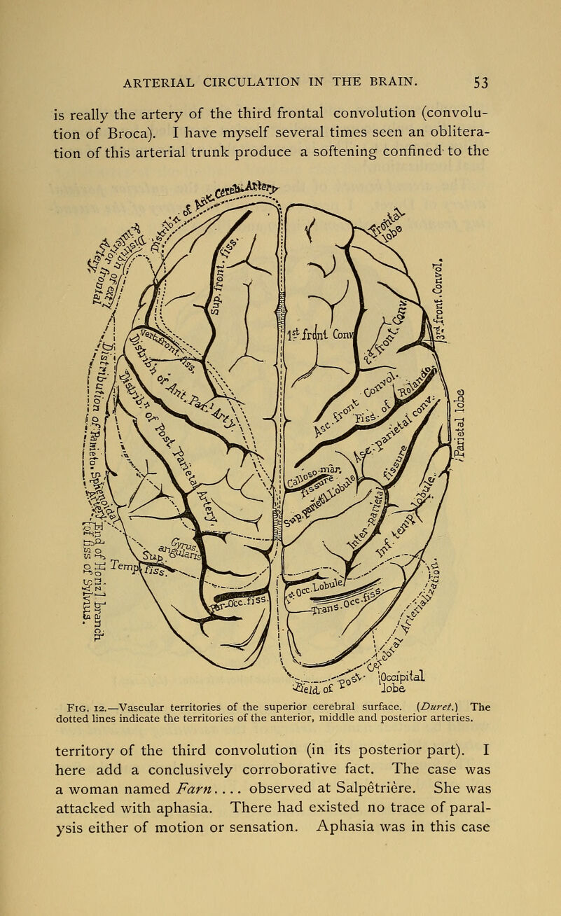 is really the artery of the third frontal convolution (convolu- tion of Broca). I have myself several times seen an oblitera- tion of this arterial trunk produce a softening confined to the , ce5^^--?^ V_ .^•^c.'v- .Occipital ■>5eM.o£^° lobe Fig. 12.—Vascular territories of the superior cerebral surface. {Dwet.') The dotted lines indicate the territories of the anterior, middle and posterior arteries. territory of the third convolution (in its posterior part). I here add a conclusively corroborative fact. The case was a woman named Farn.... observed at Salpetriere. She was attacked with aphasia. There had existed no trace of paral- ysis either of motion or sensation. Aphasia was in this case