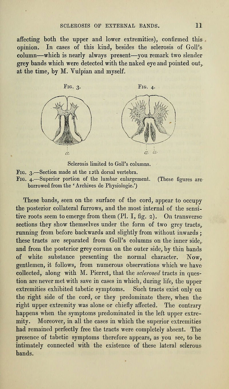 affecting both the upper and lower extremities), confirmed this opinion. In cases of this kind, besides the sclerosis of GolPs column—which is nearly always present—you remark two slender grey bands which were detected with the naked eye and pointed out, at the time, by M. Vulpian and myself. Fig. 3. Fig. ±. Sclerosis limited to Goll's columns. Fig. 3.—Section made at the 12th dorsal vertebra. Fig. 4.—Superior portion of the lumbar enlargement. (These figures are borrowed from the 'Archives de Physiologic') These bands, seen on the surface of the cord, appear to occupy the posterior collateral furrows, and the most internal of the sensi- tive roots seem to emerge from them (PL I, fig. %). On transverse sections they show themselves under the form of two grey tracts, running from before backwards and slightly from without inwards; these tracts are separated from Goll's columns on the inner side, and from the posterior grey cornua on the outer side, by thin bands of white substance presenting the normal character. Now, gentlemen, it follows, from numerous observations which we have collected, along with M. Pierret, that the sclerosed tracts in ques- tion are never met with save in cases in which, during life, the upper extremities exhibited tabetic symptoms. Such tracts exist only on the right side of the cord, or they predominate there, when the right upper extremity was alone or chiefly affected. The contrary happens when the symptoms predominated in the left upper extre- mity. Moreover, in all the cases in which the superior extremities had remained perfectly free the tracts were completely absent. The presence of tabetic symptoms therefore appears, as you see, to be intimately connected with the existence of these lateral sclerous bands.