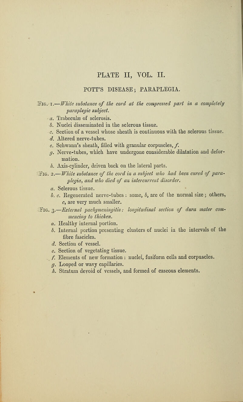 POTT'S DISEASE; PARAPLEGIA. .ITig.' i.—White substance of the cord at the compressed part in a completely paraplegic subject. a. Trabecular of sclerosis. b. Nuclei disseminated in the sclerous tissue. c. Section of a vessel whose sheath is continuous with the sclerous tissue. d. Altered nerve-tubes. e. Schwann's sheath, filled with granular corpuscles, /. g. Nerve-tubes, which have undergone considerable dilatation and defor- mation. h. Axis-cylinder, driven back on the lateral parts. ElG. 2.— White substance of the cord in a subject who had been cured of para- plegia, and who died of an intercurrent disorder. a. Sclerous tissue. b. c. Regenerated nerve-tubes : some, b, are of the normal size ; others, c, are very much smaller. Tig. 3.—External pachymeningitis: longitudinal section of dura mater com- mencing to thicken. a. Healthy internal portion. b. Internal portion presenting clusters of nuclei in the intervals of the fibre fascicles. d. Section of vessel. e. Section of vegetating tissue. /. Elements of new formation : nuclei, fusiform cells and corpuscles. g. Looped or wavy capillaries. h. Stratum devoid of vessels, and formed of caseous elements.