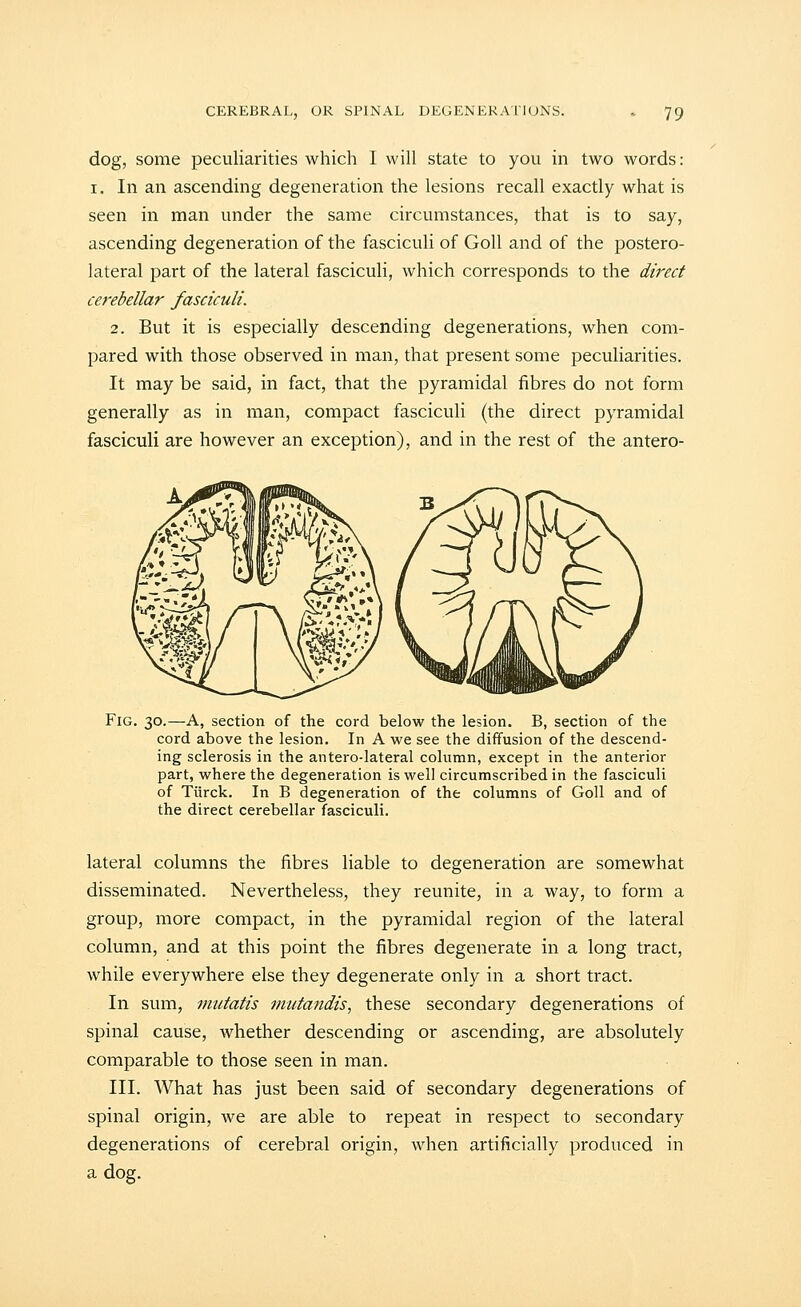 dog, some peculiarities which I will state to you in two words: I. In an ascending degeneration the lesions recall exactly what is seen in man under the same circumstances, that is to say, ascending degeneration of the fasciculi of GoU and of the postero- lateral part of the lateral fasciculi, which corresponds to the direct cerebellar fasciculi. 2. But it is especially descending degenerations, when com- pared with those observed in man, that present some peculiarities. It may be said, in fact, that the pyramidal fibres do not form generally as in man, compact fasciculi (the direct pyramidal fasciculi are however an exception), and in the rest of the antero- FiG. 30.—A, section of the cord below the lesion. B, section of the cord above the lesion. In A we see the diffusion of the descend- ing sclerosis in the antero-lateral column, except in the anterior part, where the degeneration is well circumscribed in the fasciculi of Tiirck. In B degeneration of the columns of GoU and of the direct cerebellar fasciculi. lateral columns the fibres liable to degeneration are somewhat disseminated. Nevertheless, they reunite, in a way, to form a group, more compact, in the pyramidal region of the lateral column, and at this point the fibres degenerate in a long tract, while everywhere else they degenerate only in a short tract. In sum, mutatis mutandis, these secondary degenerations of spinal cause, whether descending or ascending, are absolutely comparable to those seen in man. III. What has just been said of secondary degenerations of spinal origin, we are able to repeat in respect to secondary degenerations of cerebral origin, when artificially produced in a dog.