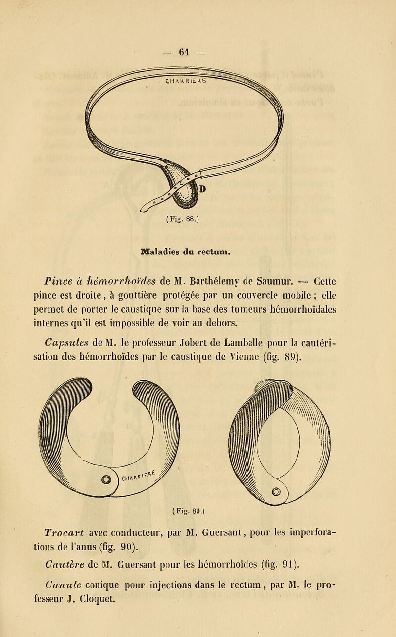 (Fig. 88.) Maladies du rectum. Pince à hémorrhordes de M. Barthélémy de Saumur. — Celte pince est droite, à gouttière protégée par un couvercle mobile ; elle permet de porter le caustique sur la base des tumeurs hémorrhoïdales internes qu'il est impossible de voir au dehors. Capsules de M. le professeur Jobert de Lamballe pour la cautéri- sation des hémorrhoïdes par le caustique de Vienne (fig. 89). (Fig. 89.) Trocart avec conducteur, par M. Guersant, pour les imperfora- lions de l'anus (fig. 90). Cautère de M. Guersant pour les hémorrhoïdes (fig. 91). Conule conique pour injections dans le rectum, par M. le pro- fesseur J. Cloquet.