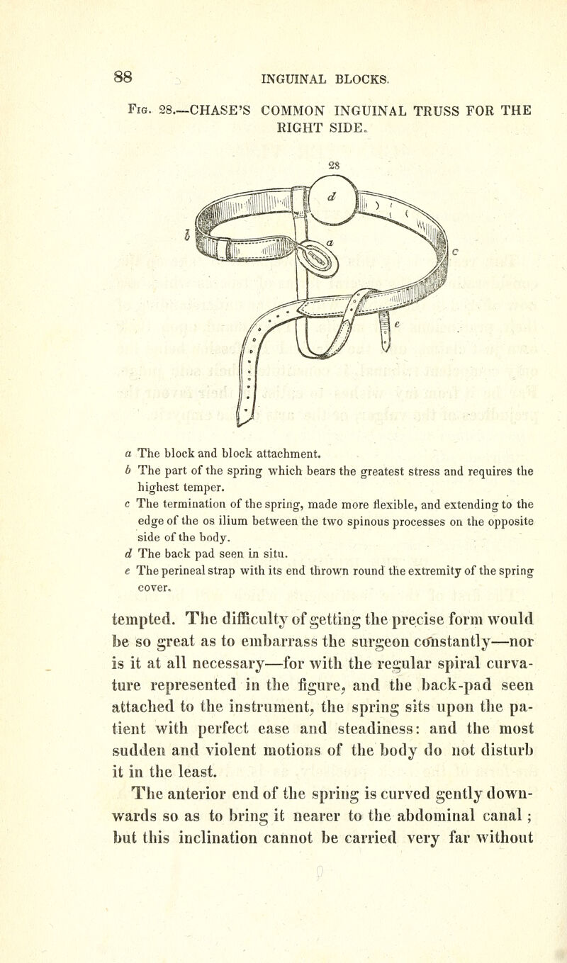 Fig. 28.—CHASE'S COMMON INGUINAL TRUSS FOR THE RIGHT SIDE. a The block and block attachment. b The part of the spring which bears the greatest stress and requires the highest temper. c The termination of the spring, made more flexible, and extending to the edge of the os ilium between the two spinous processes on the opposite side of the body. d The back pad seen in situ. e The perineal strap with its end thrown round the extremity of the spring cover. tempted. The difficulty of getting tlie precise form would be so great as to embarrass the surgeon ccfnstantly—nor is it at all necessary—for with the regular spiral curva- ture represented in the figure^ and the back-pad seen attached to the instrument^ the spring sits upon the pa- tient with perfect ease and steadiness: and the most sudden and violent motions of the body do not disturb it in the least. The anterior end of the spring is curved gently down- wards so as to bring it nearer to the abdominal canal; but this inclination cannot be carried very far without