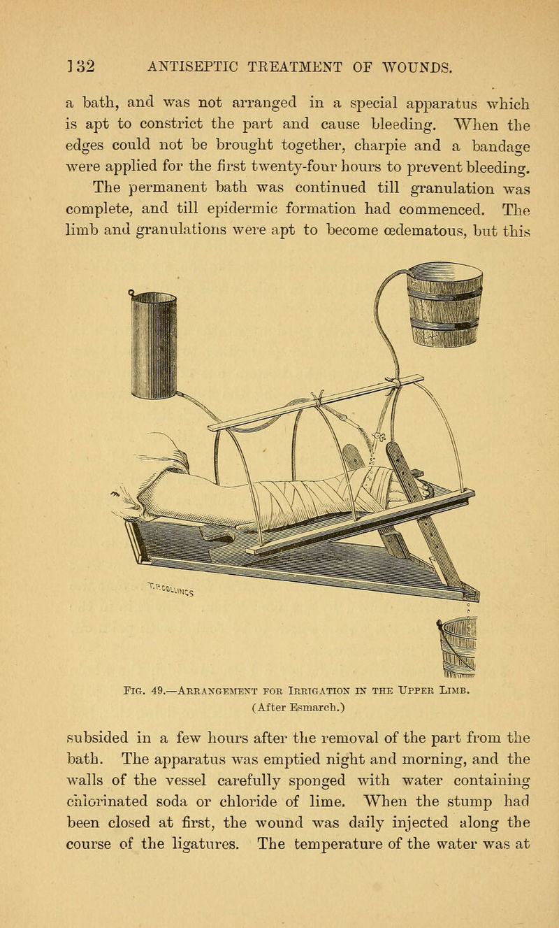 a bath, and was not arranged in a special apparatus which is apt to constrict the part and cause bleeding. When the edges could not be brought together, charpie and a bandage were applied for the first twenty-four hours to prevent bleedino-. The permanent bath was continued till granulation was complete, and till epidermic formation had commenced. The limb and granulations were apt to become cedematous, but this T-P-^LUMj Fig. 49.—Arrangement for Irrigation in the Upper Limb. (After Esmarch.) subsided in a few hours after the removal of the part from the bath. The apparatus was emptied night and morning, and the walls of the vessel carefully sponged with water containing chlorinated soda or chloride of lime. When the stump had been closed at first, the wound was daily injected along the course of the ligatures. The temperature of the water was at