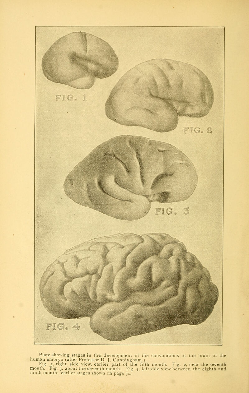 Plate showing stages in the development of the convolutions in the brain of the human embryo (after Professor D. J. Cunningham.) Fig. i, right side view, earlier part of the fifth month. Fig. 2, near the seventh month. Fig. 3, about the seventh month. Fig. 4, left side view between the eighth and ninth month; earlier stages shown on page 70.