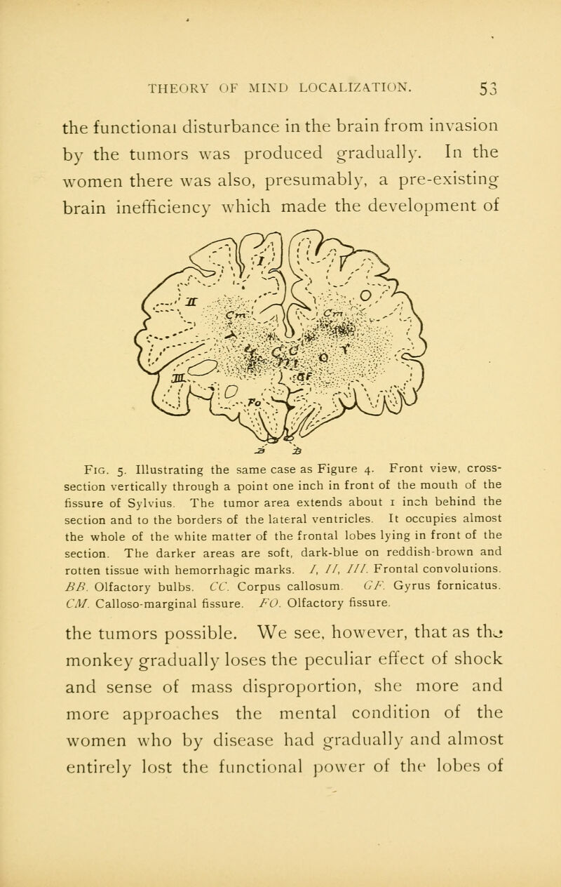 the functional disturbance in the brain from invasion by the tumors was produced gradually. In the women there was also, presumably, a pre-existing brain inefficiency which made the development of J3 & Fig. 5. Illustrating the same case as Figure 4. Front view, cross- section vertically through a point one inch in front of the mouth of the fissure of Sylvius. The tumor area extends about 1 inch behind the section and to the borders of the lateral ventricles. It occupies almost the whole of the white matter of the frontal lobes lying in front of the section. The darker areas are soft, dark-blue on reddish-brown and rotten tissue with hemorrhagic marks. /, //, III. Frontal convolutions. BB. Olfactory bulbs. CC. Corpus callosum. GF. Gyrus fornicatus. CM. Calloso-marginal fissure. FO. Olfactory fissure. the tumors possible. We see, however, that as tho monkey gradually loses the peculiar effect of shock and sense of mass disproportion, she more and more approaches the mental condition of the women who by disease had gradually and almost entirely lost the functional power of the lobes of