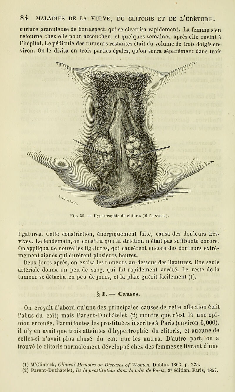 surface granuleuse de bon aspect, qui se cicatrisa rapidement. La femme s'en retourna chez elle pour accoucher, et quelques semaines après elle revint à l'hôpital. Le pédicule des tumeurs restantes était du volume de trois doigts en- viron. On le divisa en trois parties égales, qu'on serra séparément dans trois ri Fig. 38. — Hypertrophie du clitoris (M'Clintock]. ligatures. Cette constriction, énergiquement faite, causa des douleurs très- vives. Le lendemain, on constata que la striction n'était pas suffisante encore. On appliqua de nouvelles ligatures, qui causèrent encore des douleurs extrê- mement aiguës qui durèrent plusieurs heures. Deux jours après, on excisa les tumeurs au-dessous des ligatures. Une seule artériole donna un peu de sang, qui fut rapidement arrêté. Le reste de la tumeur se détacha en peu de jours, et la plaie guérit facilement (I). § I. — Causes. On croyait d'abord qu'une des principales causes de cette affection était l'abus du coït; mais Parent-Duchàtelet (2) montre que c'est là une opi- nion erronée. Parmi toutes les prostituées inscrites à Paris (environ 6,000), il n'y en avait que trois atteintes d'hypertrophie du clitoris, et aucune de celles-ci n'avait plus abusé du coït que les autres. D'autre part, on a trouvé le clitoris normalement développé chez des femmes se livrant d'une (1) M'Glintock, Cliincnl Memoirs on Disenses of Women. Dublin, 18G3, p, 225. (2) Parenl-Duchâlclet, De la prosiilulion dans la ville de Paris, 3' édition. Paris^ 1857.