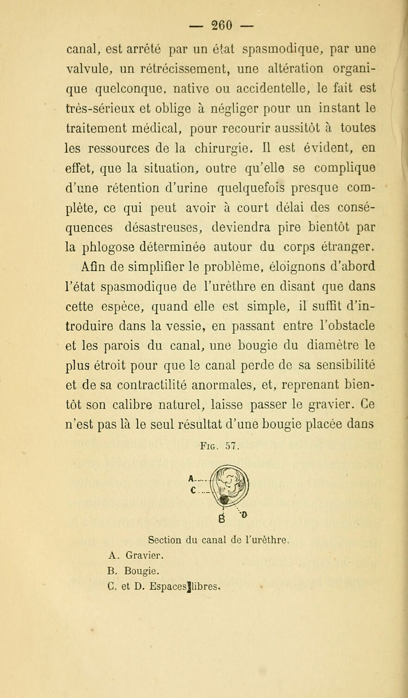 canal, est arrêté par un état spasmodique, par une valvule, un rétrécissement, une altération organi- que quelconque, native ou accidentelle, le fait est très-sérieux et oblige à négliger pour un instant le traitement médical, pour recourir aussitôt à toutes les ressources de la chirurgie. Il est évident, en effet, que la situation, outre qu'elle se complique d'une rétention d'urine quelquefois presque com- plète, ce qui peut avoir à court délai des consé- quences désastreuses, deviendra pire bientôt par la phlogose déterminée autour du corps étranger. Afin de simplifier le problème, éloignons d'abord l'état spasmodique de l'urèthre en disant que dans cette espèce, quand elle est simple, il suffit d'in- troduire dans la vessie, en passant entre l'obstacle et les parois du canal, une bougie du diamètre le plus étroit pour que le canal perde de sa sensibilité et de sa contractilité anormales, et, reprenant bien- tôt son calibre naturel, laisse passer le gravier. Ce n'est pas là le seul résultat d'une bougie placée dans ■Fig. 57. Section du canal do l'urèthre. A. Gravier. B. Bougie. C. et D. Espacesjlibres.