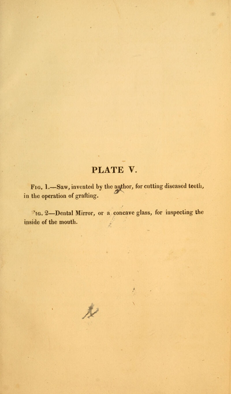 pIGt 1.—Saw, invented by the author, for cutting diseased teeth, in the operation of grafting. ■ ig. 2—Dental Mirror, or a concave glass, for inspecting the inside of the mouth. P