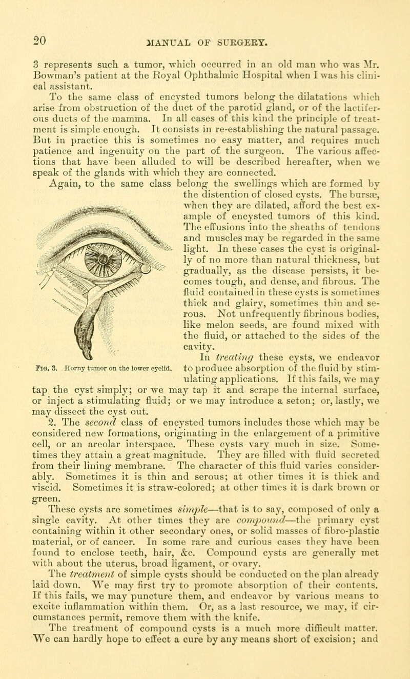 3 represents such a tumor, -nhicli occurred in an old man who was Mr. Bowman's patient at the Royal Ophthahnic Plospital when 1 was his clini- cal assistant. To the same class of encysted tumors belong the dilatations which arise from obstruction of the duct of the parotid gland, or of tlie lactifer- ous ducts of the mamma. In all cases of this kind the principle of treat- ment is simple enough. It consists in re-establisliing the natural passage. But in practice this is sometimes no easy matter, and requires much patience and ingenuity on the part of the surgeon. The various affec- tions that have been alluded to will be described hereafter, when we speak of the glands with which they are connected. Again, to the same class belong the swellings which are formed by the distention of closed cysts. The bursfe, when they are dilated, afford the best ex- ample of encysted tumors of this kind. The effusions into the sheaths of tendons and muscles may be regarded in the same light. In these cases the cyst is original- ly of no more than natural thickness, but gradually, as the disease persists, it be- comes tough, and dense, and fibrous. The fluid contained in these cysts is sometimes thick and glairy, sometimes thin and se- rous. Not unfrequently fibrinous bodies, like melon seeds, are found mixed with the fluid, or attached to the sides of the cavity. In treating these cysts, we endeavor to produce absorption of the fluid by stim- ulating applications. If this fails, we may tap the cyst simply; or we may tap it and scrape the internal surface, or inject a stimulating fluid; or we may introduce a seton; or, lastly, we may dissect the cyst out. 2. The second class of encysted tumors includes those which may be considered new formations, originating in the enlargement of a primitive cell, or an areolar interspace. These cysts vary much in size. Some- times they attain a great magnitude. They are filled with fluid secreted from their lining membrane. The character of this fluid varies consider- ably. Sometimes it is thin and serous; at other times it is thick and viscid. Sometimes it is straw-colored; at other times it is dark brown or green. These cysts are sometimes swiple—that is to say, composed of only a single cavity. At other times they are conqwund—the primary cyst containing within it other secondary ones, or solid masses of fibro-plastic material, or of cancer. In some rare and curious cases they have been found to enclose teeth, hair, &c. Compound c^'sts are generally met with about the uterus, broad ligament, or ovary. The treatment of simple cysts shouhi be conducted on the plan already laid down. We may first try to promote absorption of their contents. If this fails, we may puncture them, and endeavor by various means to excite inflammation within them. Or, as a last resource, we may, if cir- cumstances permit, remove them with the knife. The treatment of compound cysts is a much more diflicult matter. We can hardly hope to effect a cure by any means short of excision; and Fig. 3. Horny tumor on the lower eyelid.