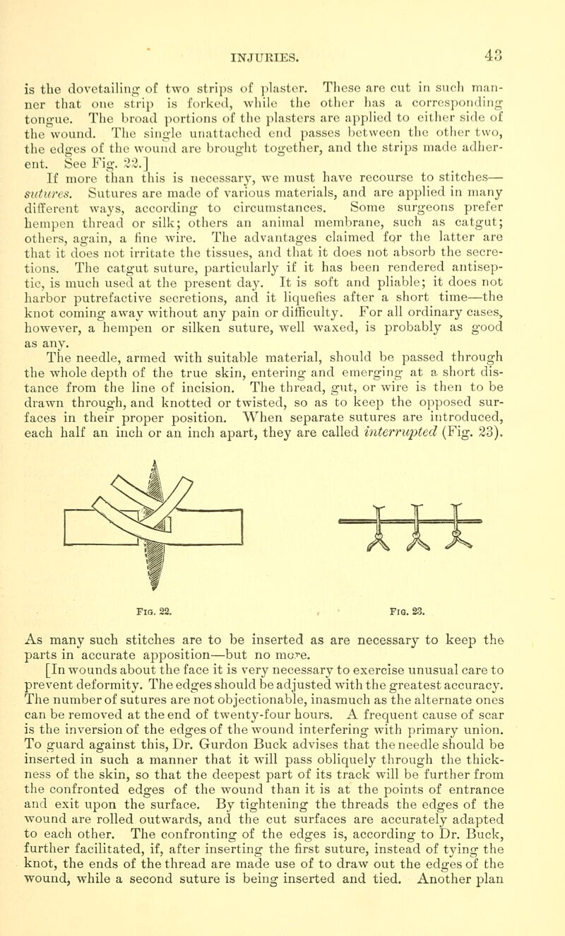 is the dovetailinp; of two strips of plaster. Tlicse are cut in such man- ner that one strip is forked, while the other has a corresponding tong-ue. The broad portions of the plasters are applied to cither side of the\vound. The single unattached end passes between the other two, the edges of the wound are brought together, and the strips made adher- ent. iSee Fig. 22.] If more than this is necessary, we must have recourse to stitches— sutures. Sutures are made of various materials, and are applied in many different ways, according to circumstances. Some surgeons prefer hempen thread or silk; others an animal membrane, such as catgut; others, again, a fine wire. The advantages claimed for the latter are that it does not irritate the tissues, and that it does not absorb the secre- tions. The catgut suture, particularly if it has been rendered antisep- tic, is much used at the present day. It is soft and pliable; it does not harbor putrefactive secretions, and it liquefies after a short time—the knot coming away without any pain or difficulty. For all ordinary cases, however, a hempen or silken suture, well waxed, is probably as good as any. The needle, armed with suitable material, should be passed through the whole depth of the true skin, entering and emerging at a short dis- tance from the line of incision. The thread, gut, or wire is then to be drawn through, and knotted or twisted, so as to keep the opposed sur- faces in their proper position. When separate sutures are introduced, each half an inch or an inch apart, they are called interrupted (Fig. 23). Fig. 22. Fig. 23. As many such stitches are to be inserted as are necessary to keep the parts in accurate apposition—but no more. [In wounds about the face it is very necessary to exercise unusual care to prevent deformity. The edges should be adjusted with the greatest accuracy. The number of sutures are not objectionable, inasmuch as the alternate ones can be removed at the end of twenty-four hours. A frequent cause of scar is the inversion of the edges of the wound interfering with primary union. To guard against this. Dr. Gurdon Buck advises that the needle should be inserted in such a manner that it will pass obliquely through the thick- ness of the skin, so that the deepest part of its track will be further from the confronted edges of the wound than it is at the points of entrance and exit upon the surface. By tightening the threads the edges of the wound are rolled outwards, and the cut surfaces are accurately adapted to each other. The confronting of the edges is, according to Dr. Buck, further facilitated, if, after inserting the first suture, instead of tying the knot, the ends of the thread are made use of to draw out the edges of the wound, while a second suture is being inserted and tied. Another plan