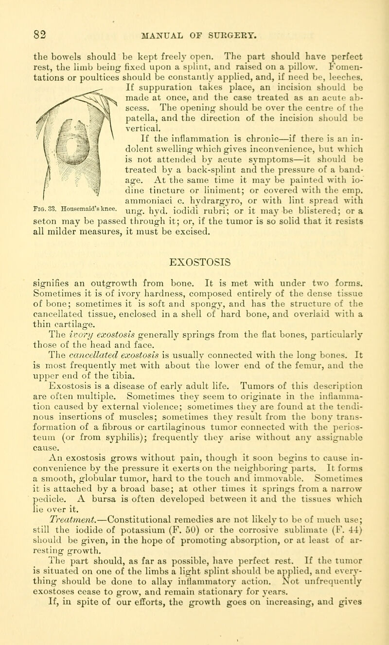 the bowels should be kept freely open. The part should have perfect rest, the limb being fixed upon a splint, and raised on a pillow. Fomen- tations or poultices should be constantly applied, and, if need be, leeches. If suppuration takes place, an incision should be made at once, and the case treated as an acute ab- scess. The opening- should be over the centre of the patella, and the direction of the incision should be vertical. If the inflammation is chronic—if there is an in- dolent swelling which gives inconvenience, but which is not attended by acute symptoms—it should be treated by a back-splint and the pressure of a band- age. At the same time it may be painted with io- dine tincture or liniment; or covered Avith the emp. ammoniaci c. hydrargyro, or with lint spread with Fig.33. Hoasemaid'sknee. ung. hyd. iodidi rubri; or it may be blistered; or a seton may be passed through it; or, if the tumor is so solid that it resists all milder measures, it must be excised. EXOSTOSIS signifies an outgrowth from bone. It is met with under two forms. Sometimes it is of ivory hardness, composed entirely of the dense tissue of bone; sometimes it is soft and spongy, and has the structure of the cancellated tissue, enclosed in a shell of hard bone, and overlaid with a thin cartilage. The ivory exostosis generally springs from the flat bones, particularly those of the head and face. The cancellated exostosis is usually connected with the long bones. It is most frequently met with about the lower end of the femur, and the upper end of the tibia. Exostosis is a disease of early adult life. Tumors of this description are often multiple. Sometimes they seem to originate in tiie iniiaiuma- tion caused by external violence; sometimes they are found at the tendi- nous insertions of muscles; sometimes they result from the bony trans- formation of a fibrous or cartilaginous tumor connected with the perios- teum (or from syphilis); frequently they arise without any assignable cause. An exostosis grows without pain, though it soon begins to cause in- convenience by the pressure it exerts on the neighboring parts. It forms a smooth, globular tumor, hard to tl)e touch and inunovablo. Sometimes it is attached by a broad base; at other times it springs from a narrow pedicle. A bursa is often developed between it and the tissues which lie over it. Treatment,—Constitutional remedies are not likely to be of much use; still the iodide of potassium (F. 50) or the corrosive sublimate (F. 44) should be given, in the hope of promoting absorption, or at least of ar- resting growth. The part should, as far as possible, liave perfect rest. If the tumor is situated on one of tlie limbs a light splint should be applied, and every- thing should be done to allay inflammatory action. Not unfrequently exostoses cease to grow, and remain stationary for years. If, in spite of our efforts, the growth goes on increasing, and gives