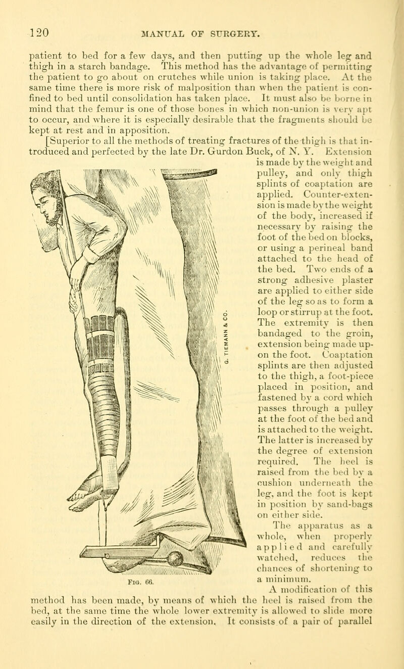 patient to bed for a few days, and then putting up the whole leg and thigh in a starch bandage. This method has the advantage of permitting the jjatient to go about on crutches while union is taking place. At the same time there is more risk of malposition than when the patient is con- fined to bed until consolidation has taken place. It must also be borne in mind that the femur is one of those bones in which non-union is very apt to occur, and where it is especially desirable that the fragments should be kept at rest and in apposition. [Superior to all the methods of treating fractures of the thigh is that in- troduced and perfected by the late Dr. Gurdon Buck, of X. Y. Extension is made b}' the weight and pulley, and only thigh splints of coaptation are applied. Counter-exten- sion is made by the weight of the body, increased if necessary by raising the foot of the bed on blocks, or using a perineal band attached to the head of the bed. Two ends of a strong adhesive plaster are applied to either side of the leg so as to form a loop or stirrup at the foot. The extremity is then bandaged to the groin, extension being made up- on the foot. Coaptation splints are then adjusted to the thigh, a foot-piece placed in position, and fastened by a cord which passes through a pulley at the foot of the bed and is attached to the weight. The latter is increased by the degree of extension required. The heel is raised from the bed by a cushion iniderneath the leg, and the foot is kept in position by sand-bags on either side. The apparatus as a whole, when properly applied and carefully watched, reduces the chances of shortening to a minimum. A modification of this method has been made, by means of which the heel is raised from the bed, at the same time the whole lower extremity is allowed to slide more easily in the direction of the extension. It consists of a pair of parallel Fig