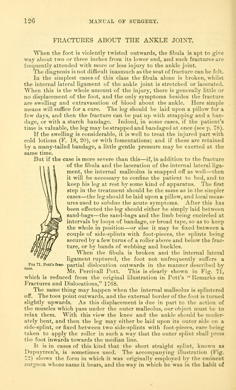 FRACTURES ABOUT THE ANKLE JOINT. When the foot is violently twisted outwards, the fibula is apt to give way about two or three inches from its lower end, and such fractures are frequently attended with more or less injury to the ankle joint. The diagnosis is not difficult inasmuch as the seat of fracture can be felt. In the simplest cases of this class the fibula alone is broken, whilst the internal lateral ligament of the ankle joint is stretched or lacerated. When this is the whole amount of the injury, there is generally little or no displacement of the foot, and the only symptoms besides the fracture are swelling and extravasation of blood about the ankle. Here simple means will suffice for a cure. The leg should be laid upon a pillow for a few days, and then the fracture can be put up with strapping and a ban- dage, or with a starch bandage. Indeed, in some cases, if the patient's time is valuable, the leg may be strapped and bandaged at once (see p. 78). If the swelling is considerable, it is well to treat the injured part with cold lotions (F. 18, 20), or with fomentations; and if these are retained by a many-tailed bandage, a little gentle pressure may be exerted at the same time. But if the case is more severe than this—if, in addition to the fracture of the fibula and the laceration of the internal lateral liga- ment, the internal malleolus is snapped off as well—then it will be necessary to confine the patient to bed, and to keep his leg at rest by some kind of apparatus. The first step in the treatment should be the same as in the simpler cases—the leg should be laid upon a pillow, and local meas- ures used to subdue the acute symptoms. After this has been effected the leg should either be simply laid between sand-bags—the sand-bags and the limb being encircled at intervals by loops of bandage, or broad tape, so as to keep the whole in position—or else it ma}^ be fixed between a couple of side-splints with foot-pieces, the splints being secured by a few turns of a roller above and below the frac- ture, or by bands of webbing and buckles. When the fibula is broken and the internal lateral ligament ruptured, the foot not unfrequently suffers a Fig 71. Pott's frac- partial dislocation outwards in the manner described by Mr. Percivall Pott. This is clearly shown in Fig. 71, which is reduced from the original illustration in Pott's  Remarks on Fractures and Dislocations, 1768. The same thing may happen when the internal malleolus is splintered off. The toes point outwards, and the external border of the foot is turned slightly upwards. As this displacement is due in part to the actioTi of the muscles which pass under the outer malleolus, our object must be to relax them. With this view the knee and the ankle should be moder- ately bent, and then the leg may either be laid upon its outer side on a side-splint, or fixed between two side-splints with foot-pieces, care being taken to apply the roller in such a way that the outer s])lint shall press the foot inwards towards the median line. It is in cases of this kind that the short straight splint, known as Dupuytren's, is sometimes used. The accompanving illustration (Fig. 7'2) sliows the form in which it was originally employed by the eminent surgeon whose name it bears, and the way in which he was in the habit of