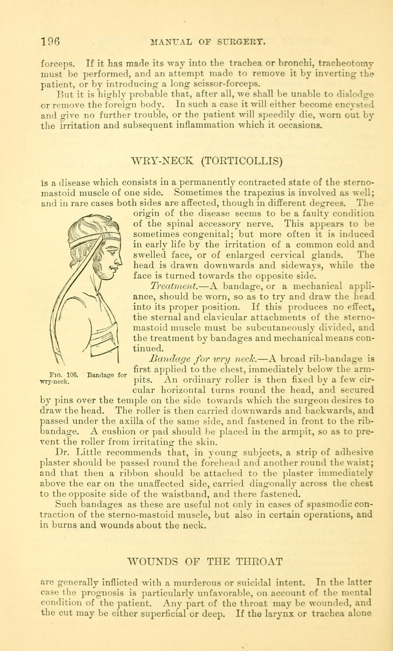 forceps. If it has made its way into the trachea or bronchi, tracheotomy must be performed, and an attempt made to remove it by inverting the patient, or by introducing a long scissor-forceps. ]kit it is liighly probable that, after all, we shall be unable to dislodge or remove the foreign body. In such a case it will either become encysted and give no further trouble, or the patient will speedily die, worn out by the irritation and subsequent inflammation which it occasions. WRY-NECK (TORTICOLLIS) is a disease which consists in a permanently contracted state of the sterno- mastoid muscle of one side. Sometimes the trapezius is involved as well; and in rare cases both sides are affected, though in different degrees. The origin of the disease seems to be a faulty condition of the spinal accessory nerve. This appears to be sometimes congenital; but more often it is induced in early life by the irritation of a common cold and swelled face, or of enlarged cervical glands. The head is drawn downwards and sideways, while the face is turned towards the opposite side. Treatment.—A bandage, or a mechanical appli- ance, should be worn, so as to try and draw the head into its proper position. If this produces no effect, the sternal and clavicular attachments of the sterno- mastoid muscle must be subcutaneously divided, and the treatment by bandages and mechanical means con- tinued. Bandage for lory neck.—A broad rib-bandage is first applied to the chest, immediately below the arm- pits. An ordinary roller is then fixed by a few cir- cular horizontal turns round the head, and secured by pins over the temple on the side towards which the surgeon desires to draw the head. The roller is then carried downwards and backwards, and passed under the axilla of the same side, and fastened in front to the rib- bandage. A cushion or pad should l)e placed in the armpit, so as to pre- vent the roller from irritating the skin. Dr. Little recommends that, in young subjects, a strip of adhesive plaster should be passed round the forehead and another round the waist; and that then a ribbon should be attached to the plaster innnediately above the ear on the unaffected side, carried diagonally across the chest to the opposite side of the waistband, and there fastened. Such bandages as these are useful not only in cases of spasmodic con- traction of the sterno-mastoid muscle, but also in certain operations, and in burns and wounds about the neck. Fig. 106. Bandage for wry-neck. WOUNDS OF THE THROAT are generally inflicted with a murderous or suicidal intent. In the latter case the prognosis is particularly unfavorable, on account of the mental condition of the patient. Any part of the throat may be wounded, and the cut may be either superficial or deep. If the larynx or trachea alone
