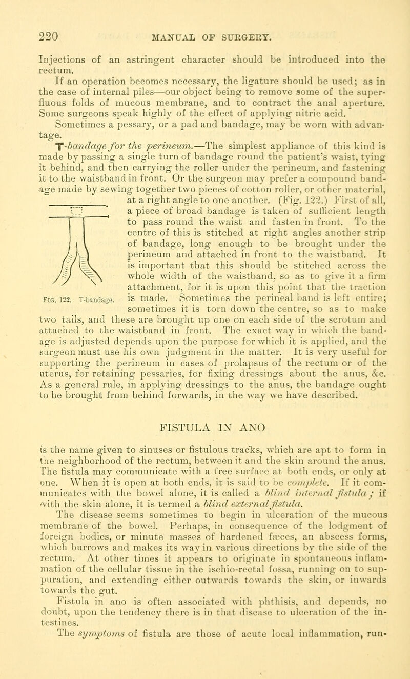 Injections of an astringent character should be introduced into the rectum. If an operation becomes necessary, the ligature should be used; as in the case of internal piles—our object being to remove some of the super- fluous folds of mucous membrane, and to contract the anal aperture. Some surgeons speak highly of the effect of applying nitric acid. Sometimes a pessary, or a pad and bandage, may be worn with advan- tage, T-handagefor the perineum.—The simplest appliance of this kind is made by passing a single turn of bandage round the patient's waist, tying it behind, and then carrying the roller under the perineum, and fastening it to the waistband in front. Or the surgeon may prefer a compound band- age made by sewing together two pieces of cotton roller, or other material, at a right angle to one another. (Fig. 122.) First of all, X}: a piece of broad bandage is taken of sufficient length Jl to pass round the waist and fasten in front. To the I centre of this is stitched at right angles another strip ,1 I of bandage, long enough to be brought under the ;yv J perineum and attached in front to the waistband. It / \^L is important that this should be stitched across the ' ^^ whole width of the waistband, so as to give it a firm attachment, for it is upon this point that the traction Fig. 122. T-bandage. is made. Sometimes the perineal band is left entire; sometimes it is torn down the centre, so as to make two tails, and these are brought up one on each side of the scrotum and attached to the waistband in front. The exact way in which the band- age is adjusted depends upon the purpose for which it is applied, and the Burgeon must use his own judgment in the matter. It is very useful for supporting the perineum in cases of prolapsus of the rectum or of the uterus, for retaining pessaries, for fixing dressings about the anus, &c. As a g-eneral rule, in applying* dressings to the anus, the bandage ought to be brought from behind forwards, in the way we have described. FISTULA IN AXO (s the name given to sinuses or fistulous traclvs, M-hich are apt to form in the neighborhood of the rectum, between it and tlie skin around the anus. The fistula may communicate with a free surface at both ends, or only at one. ^Yhen it is open at both ends, it is said to be complete. If it com- municates with the bowel alone, it is called a blind internal Jistula / if '^'ith the skin alone, it is termed a blind externcdJistula. The disease seems sometimes to begin in ulceration of the mucous membrane of the bowel. Perhaps, in consequence of the lodgment of foreign bodies, or minute masses of hardened f;i?ces, an abscess forms, which burrows and makes its way in various directions by the side of the rectum. At other times it appears to originate in spontaneous inllam- mation of the cellular tissue in the ischio-rectal fossa, running on to sup- puration, and extending either outwards towards the skin, or inwards towards the gut. Fistula in ano is often associated with phthisis, and depends, no doubt, upon the tendency there is in that tlisease to ulceration of the in- testines. The sijin2)tonis of fistula are tliose of acute local inllammation, run-