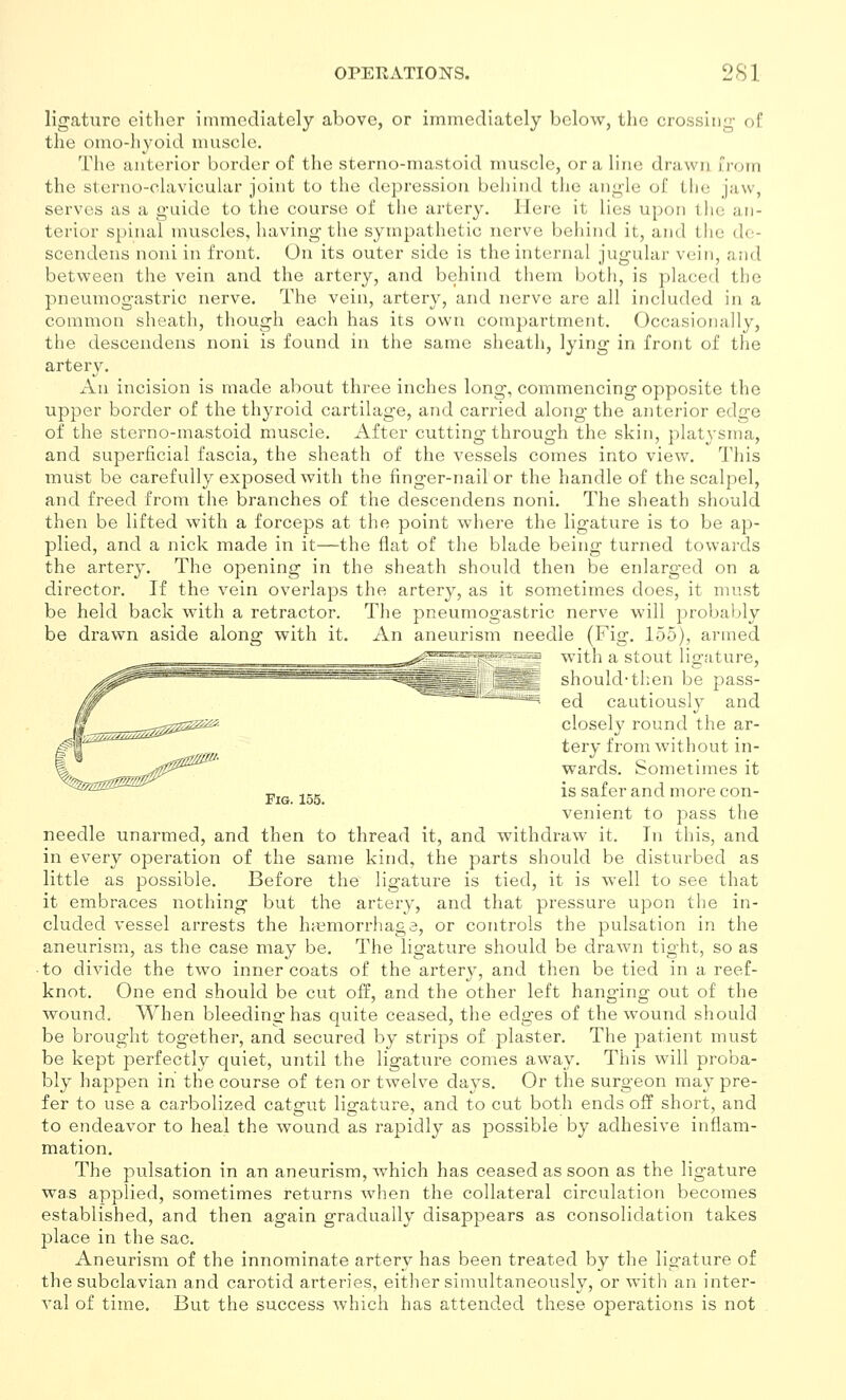 be drawn aside alonar with it. ligature cither immediately above, or immediately below, the crossing- of the omo-hyoid muscle. The anterior border of the sterno-mastoid muscle, or a line drawn from the sterno-clavicular joint to the depression behind the angle of the jaw, serves as a guide to the course of the artery. Here it lies upon the an- terior spuial muscles, having the sympathetic nerve behind it, and the de- scendens noni in front. On its outer side is the internal jugular vein, and between the vein and the artery, and behind them both, is placed the pneumogastric nerve. The vein, artery, and nerve are all included in a common sheath, though each has its own compartment. Occasionally, the descendens noni is found in the same sheath, lying in front of the artery. An incision is made about three inches long, commencing opposite the upper border of the thyroid cartilage, and carried along the anterior edge of the sterno-mastoid muscle. After cutting through the skin, platysma, and superficial fascia, the sheath of the vessels comes into view. This must be carefully exposed with the finger-nail or the handle of the scalpel, and freed from the branches of the descendens noni. The sheath should then be lifted with a forceps at the point where the ligature is to be ap- plied, and a nick made in it—the flat of the blade being turned towards the artery. The opening in the sheath should then be enlarged on a director. If the vein overlaps the artery, as it sometimes does, it must be held back with a retractor. The pneumogastric nerve will jarobably An aneurism needle (Fig. 155), armed with a stout lig-ature, should-then be pass- ed cautiously and closely round the ar- tery from without in- wards. Sometimes it is safer and more con- venient to pass the needle unarmed, and then to thread it, and withdraw it. In this, and in every operation of the same kind, the parts should be disturbed as little as possible. Before the ligature is tied, it is well to see that it embraces nothing but the artery, and that pressure upon the in- cluded vessel arrests the hicmorrhag3, or controls the pulsation in the aneurism, as the case may be. The ligature should be drawn tight, so as ■to divide the two inner coats of the artery, and then be tied in a reef- knot. One end should be cut off, and the other left hanging out of the wound. When bleeding has quite ceased, the edges of the wound should be brought together, and secured by strips of plaster. The patient must be kept perfectly quiet, until the ligature comes away. This will proba- bly happen in the course of ten or twelve days. Or the surgeon may pre- fer to use a carbolized catgut ligature, and to cut both ends off short, and to endeavor to heal the wound as rapidly as possible by adhesive inflam- mation. The pulsation in an aneurism, which has ceased as soon as the ligature was applied, sometimes returns when the collateral circulation becomes established, and then again gradually disappears as consolidation takes place in the sac. Aneurism of the innominate artery has been treated by the ligature of the subclavian and carotid arteries, either simultaneously, or with an inter- val of time. But the success which has attended these operations is not Fig. 155.