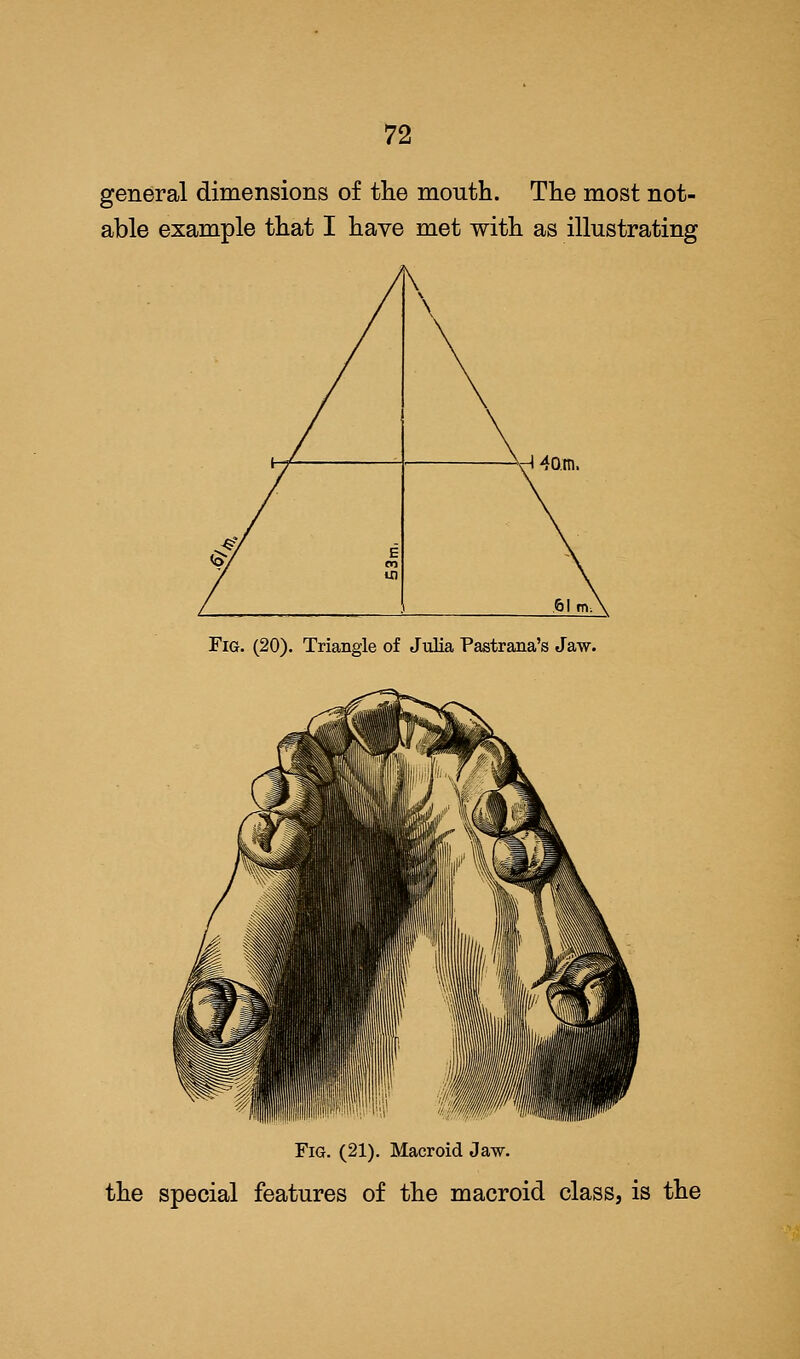 general dimensions of the mouth. The most not- able example that I have met with as illustrating H 40.m. Fig. (20). Triangle of Julia Pastrana's Jaw. Fig. (21). Macroid Jaw. the special features of the macroid class, is the
