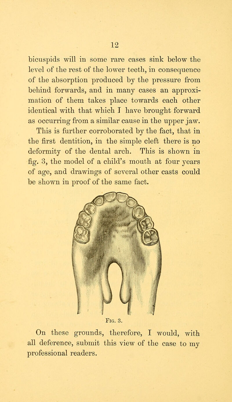 bicuspids will in some rare cases sink below the level of the rest of the lower teeth, in consequence of the absorption produced by the pressure from behind forwards, and in many cases an approxi- mation of them takes place towards each other identical with that which I have brought forward as occurring from a similar cause in the upper jaw. This is further corroborated by the fact, that in the first dentition, in the simple cleft there is no deformity of the dental arch. This is shown in fig. 3, the model of a child's mouth at four years of age, and drawings of several other casts could be shown in proof of the same fact. Fig. 3. On these grounds, therefore, I would, with all deference, submit this view of the case to my professional readers.