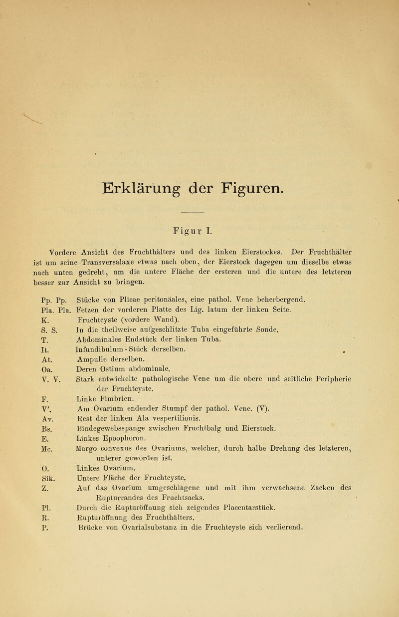 Erklärung der Figuren. Figur I. Vordere Ansicht des Fruchthälters und des linken Eierstockes. Der Fruchthälter ist um seine Transversalaxe etwas nach oben, der Eierstock dagegen um dieselbe etwas nach unten gedreht, um die untere Fläche der ersteren und die untere des letzteren besser zur Ansicht zu bringen. Pp. Pp. Stücke von Plicae peritonäales, eine pathol. Vene beherbergend. Pia. Pia. Fetzen der vorderen Platte des Lig. latum der linken Seite. K. Fruchtcyste (vordere Wand). S. S. In die theilweise aufgeschlitzte Tuba eingeführte Sonde. T. Abdominales Endstück der linken Tuba. It. Infundibulum - Stück derselben. At. Ampulle derselben. Oa. Deren Ostium abdominale. V. V. Stark entwickelte pathologische Vene um die obere und seitliche Peripherie der Fruchtcyste. F. Linke Fimbrien. V. Am Ovarium endender Stumpf der pathol. Vene. (V). Av. Rest der linken Ala vespertilionis. Bs. Bindegewebsspange zwischen Fruchtbalg und Eierstock. E. Linkes Epoophoron. Mc. Margo couvexus des Ovariums, welcher, durch halbe Drehung des letzteren, unterer geworden ist. 0. Linkes Ovarium. Sik. Untere Fläche der Fruchtcyste. Z. Auf das Ovarium umgeschlagene und mit ihm verwachsene Zacken des Rupturrandes des Fruchtsacks. PI. Durch die Rupturöffnung sich zeigendes Placentarstück. R. Rupturöffnung des Fruchthälters. p. Brücke von Ovarialsubstanz in die Fruchtcyste sich verlierend.