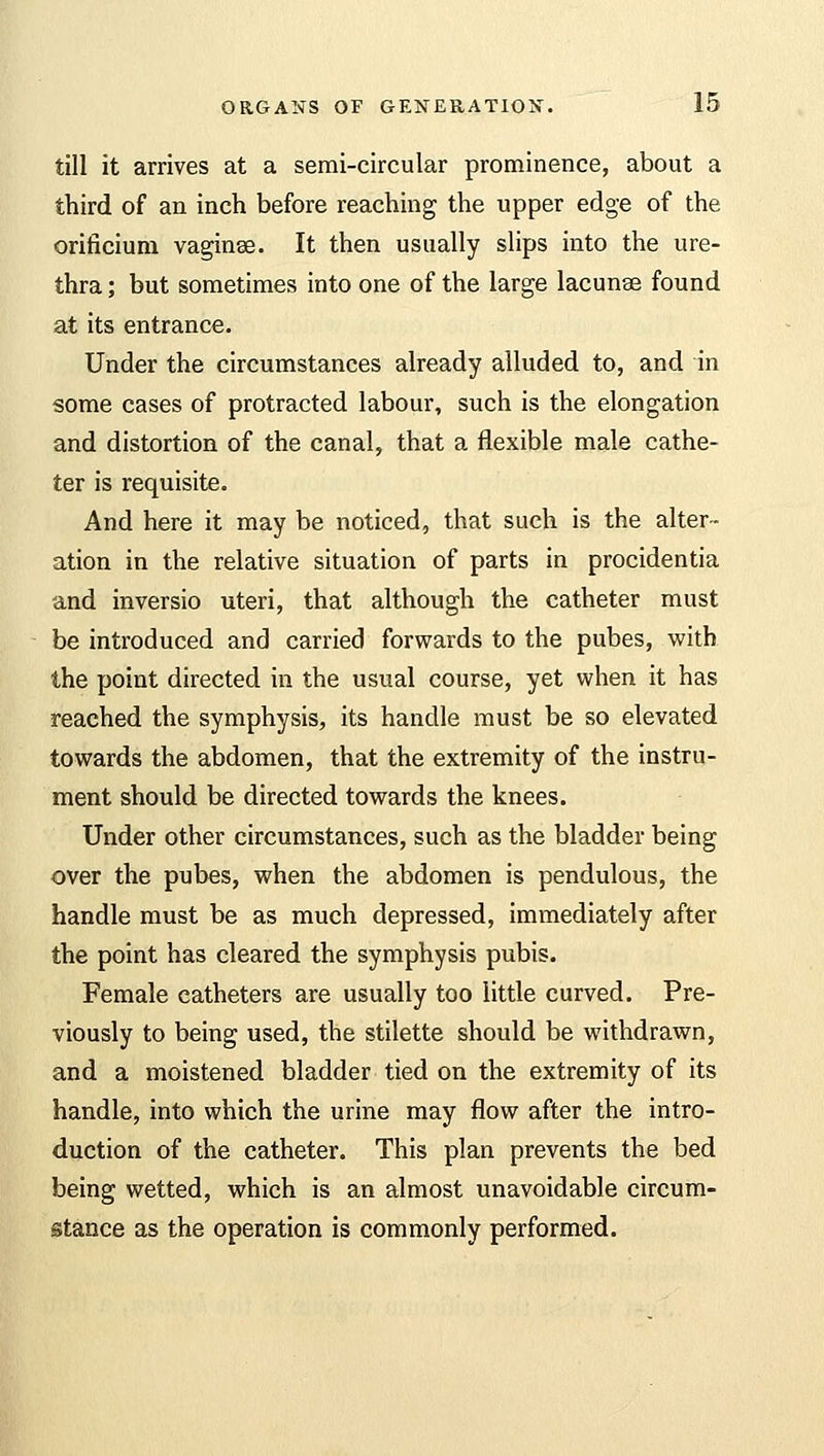 till it arrives at a serai-circular prominence, about a third of an inch before reaching the upper edge of the orificium vaginae. It then usually slips into the ure- thra ; but sometimes into one of the large lacunae found at its entrance. Under the circumstances already alluded to, and in some cases of protracted labour, such is the elongation and distortion of the canal, that a flexible male cathe- ter is requisite. And here it may be noticed, that such is the alter- ation in the relative situation of parts in procidentia and inversio uteri, that although the catheter must be introduced and carried forwards to the pubes, with the point directed in the usual course, yet when it has reached the symphysis, its handle must be so elevated towards the abdomen, that the extremity of the instru- ment should be directed towards the knees. Under other circumstances, such as the bladder being over the pubes, when the abdomen is pendulous, the handle must be as much depressed, immediately after the point has cleared the symphysis pubis. Female catheters are usually too little curved. Pre- viously to being used, the stilette should be withdrawn, and a moistened bladder tied on the extremity of its handle, into which the urine may flow after the intro- duction of the catheter. This plan prevents the bed being wetted, which is an almost unavoidable circum- stance as the operation is commonly performed.