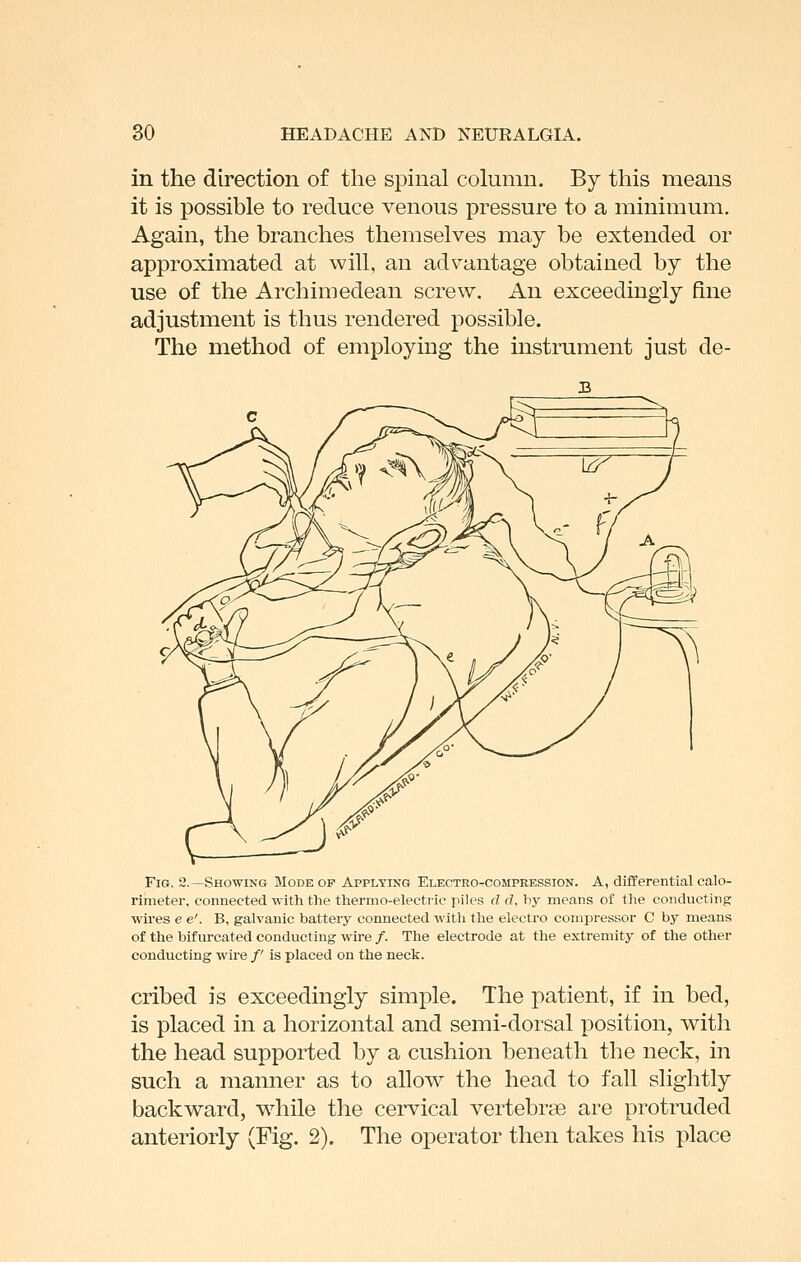 in the direction of the spinal column. By this means it is possible to reduce venous pressure to a minimum. Again, the branches themselves may be extended or approximated at will, an advantage obtained by the use of the Archimedean screw. An exceedingly fine adjustment is thus rendered possible. The method of employing the instrument just de- FiG. 2.—Showing Mode op Applying Electro-compression. A, differential calo- rimeter, connected with tlie thermo-electric piles d d, bj' means of the conducting wires e e'. B, galvanic battery connected with the electro compressor C by means of the bifurcated conducting wire /. The electrode at the extremity of the other conducting wire /' is placed on the neck. cribed is exceedingly simple. The patient, if in bed, is placed in a horizontal and semi-dorsal position, with the head supported by a cushion beneath the neck, in such a manner as to allow the head to fall slightly backward, while the cervical vertebrae are protruded anteriorly (Fig. 2). The operator then takes his place