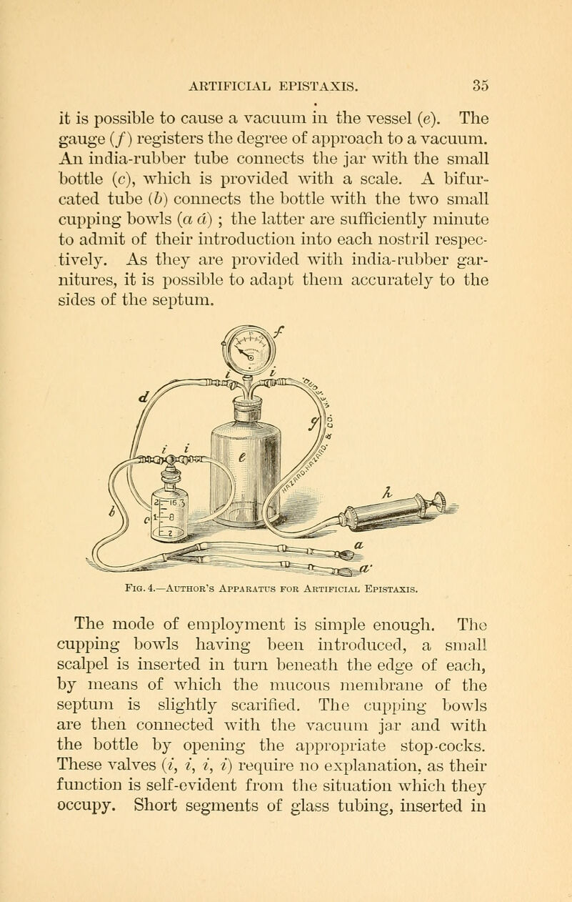 it is possible to cause a vacuum iu the vessel (e). The gauge (/) registers the degree of approach to a vacuum. An india-rubber tube connects the jar with the small bottle (c), which is provided with a scale. A bifur- cated tube ib) connects the bottle with the two small cupping bowls {a a) ; the latter are sufficiently minute to admit of their introduction into each nostril respec- tively. As they are provided with india-rubber gar- nitures, it is possible to adapt them accurately to the sides of the septum. Fig. 4.—Author's Apparatus for Artificial Epistaxis. The mode of employment is simple enough. The cupping bowls having been introduced, a small scalj)el is inserted in turn beneath the edge of each, by means of which the mucous membrane of the septum is slightly scarified. The cupping bowls are then connected with the vacuum jar and with the bottle by opening the appropriate stop-cocks. These valves {i, i, i, i) require no explanation, as their function is self-evident from the situation which they occupy. Short segments of glass tubing, inserted in