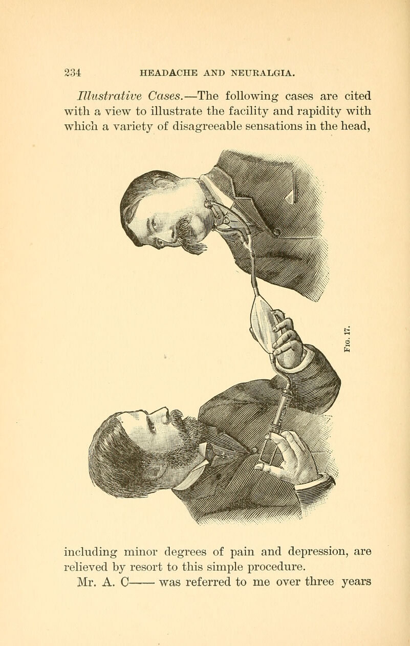 Illustrative Cases.—The following cases are cited with a view to illustrate the facility and rapidity with which a variety of disagreeable sensations in the head, including minor degrees of pain and depression, are relieved by resort to this simple procedure. Mr. A. C was referred to me over three years