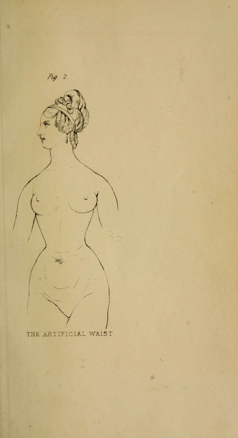 Fig. 2. \ Y THE ARTIFICIAL WAIST