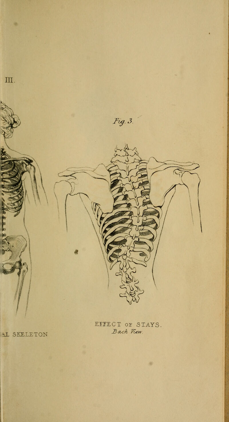 in. iX SKELETON EFFECT or STAYS