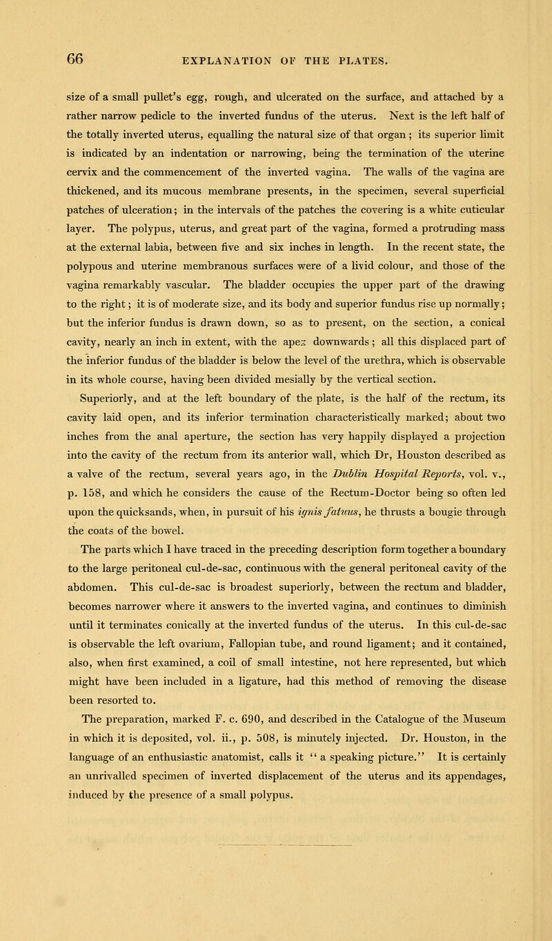 size of a small pullet's egg, rough, and ulcerated on the surface, and attached by a rather narrow pedicle to the inverted fundus of the uterus. Next is the left half of the totally inverted uterus, equalling the natural size of that organ ; its superior limit is indicated by an indentation or narrowing, being the termination of the uterine cervix and the commencement of the inverted vagina. The walls of the vagina are thickened, and its mucous membrane presents, in the specimen, several superficial patches of ulceration; in the intervals of the patches the covering is a white cuticular layer. The polypus, uterus, and great part of the vagina, formed a protruding mass at the external labia, between five and six inches in length. In the recent state, the polypous and uterine membranous surfaces were of a livid colour, and those of the vagina remarkably vascular. The bladder occupies the upper part of the drawing to the right; it is of moderate size, and its body and superior fundus rise up normally; but the inferior fundus is drawn down, so as to present, on the section, a conical cavity, nearly an inch in extent, with the apex downwards ; all this displaced part of the inferior fundus of the bladder is below the level of the urethra, which is observable in its whole course, having been divided mesially by the vertical section. Superiorly, and at the left boundary of the plate, is the half of the rectum, its cavity laid open, and its inferior termination characteristically marked; about two inches from the anal aperture, the section has very happily displayed a projection into the cavity of the rectum from its anterior wall, which Dr, Houston described as a valve of the rectum, several years ago, in the Dublin Hospital Reports, vol. v., p. 158, and which he considers the cause of the Rectum-Doctor being so often led upon the quicksands, when, in pursuit of his ignis fatuus, he thrusts a bougie through the coats of the bowel. The parts which I have traced in the preceding description form together a boundary to the large peritoneal cul-de-sac, continuous with the general peritoneal cavity of the abdomen. This cul-de-sac is broadest superiorly, between the rectum and bladder, becomes narrower where it answers to the inverted vagina, and continues to dimmish until it terminates conically at the inverted fundus of the uterus. In this cul-de-sac is observable the left ovarium, Fallopian tube, and round ligament; and it contained, also, when first examined, a coil of small intestine, not here represented, but which might have been included in a ligature, had this method of removing the disease been resorted to. The preparation, marked F. c. 690, and described in the Catalogue of the Museum in which it is deposited, vol. ii., p. 508, is minutely injected. Dr. Houston, in the language of an enthusiastic anatomist, calls it  a speaking picture. It is certainly an unrivalled specimen of inverted displacement of the uterus and its appendages, induced by the presence of a small polypus.