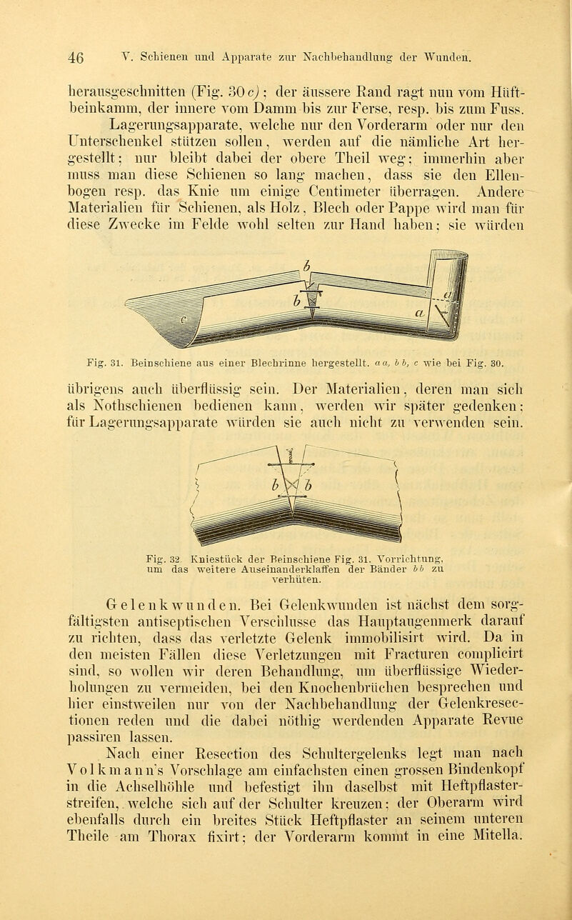 heraiisg'eschnitten (Fig. 30 c) ; der äussere Eand ragt mm vom Hiift- beinkamm, der innere vom Damm bis zm* Ferse, resp. bis zum Fuss. Lagerungsapparate, welche nur den Vorderarm oder nur den Unterschenkel stützen sollen, werden auf die nämliche Art her- gestellt; nur bleibt dabei der obere Theil weg; immerhin aber muss man diese Schienen so lang machen, dass sie den Ellen- bogen resp. das Knie um einige Centimeter überragen. Andere Materialien für Schienen, als Holz, Blech oder Pappe wird man für diese Zwecke im Felde wohl selten zur Hand haben; sie würden Fig. 31. Beinscliiene aus einer Blechrinne liergestellt. aa, hb, c wie bei Fig. 30. übrigens auch überflüssig sein. Der Materialien, deren man sich als Nothschienen bedienen kann, werden wir später gedenken; ftir Lagerungsapparate würden sie auch nicht zu verwenden sein. Fig. 32. Kniestück der Reinschiene Fig. 31. Vorrichtung, um das weitere Auseinanderklaffen der Bänder bb zu verhüten. Greleuk wunden. Bei Gelenkwunden ist nächst dem sorg- fältigsten antiseptischen Verschlusse das Hauptaugenmerk darauf zu richten, dass das verletzte Gelenk immobilisirt wird. Da in den meisten Fällen diese Verletzungen mit Fracturen complicirt sind, so wollen wir deren Behandlung, um überflüssige Wieder- holungen zu vermeiden, bei den Knochenbrüchen besprechen und hier einstweilen nur von der Nachbehandlung der Gelenkresec- tionen reden und die dabei nöthig werdenden Apparate Revue passiren lassen. Nach einer Resection des Schultergelenks legt man nach V 01 k m a n n's Vorschlage am einfachsten einen grossen Bindenkopf in die Achselhöhle und befestigt ihn daselbst mit Heftpflaster- streifen, welche sich auf der Schulter kreuzen; der Oberarm wird ebenfalls durch ein breites Stück Heftpflaster an seinem unteren Theile am Thorax fixirt: der Vorderarm kommt in eine Mitella.